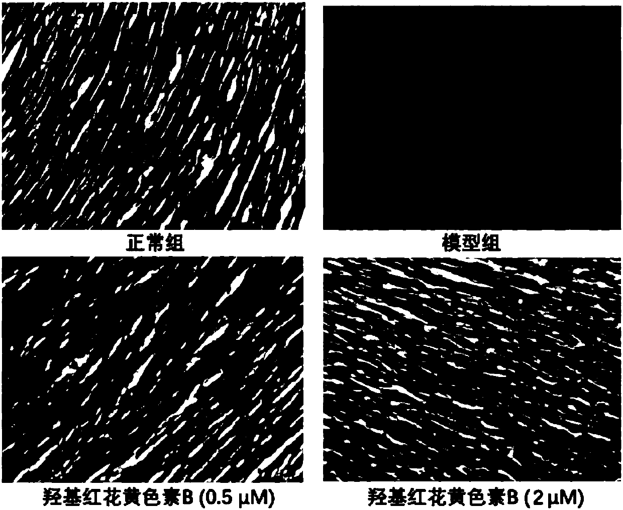 Application of hydroxysafflor yellow B in prevention and treatment of myocardial ischemia reperfusion injury