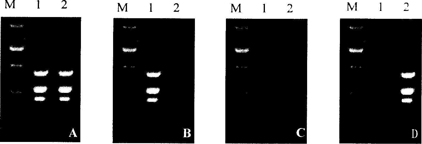 Fast inspection reagent kit for streptococcus suis 2-type triple PCR