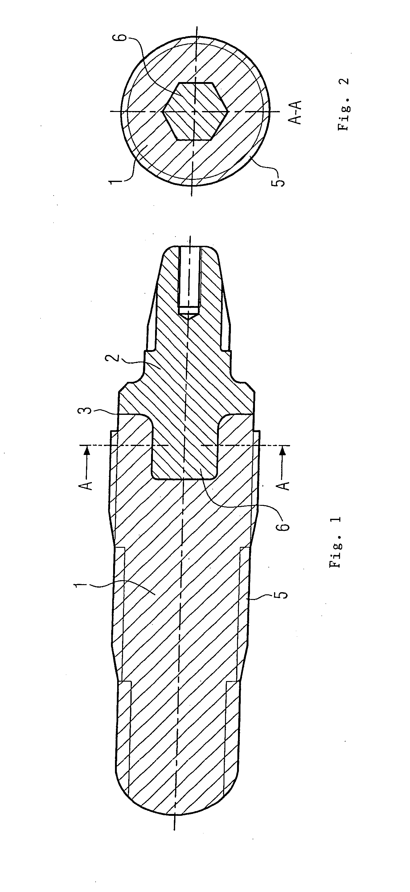 Dental implant