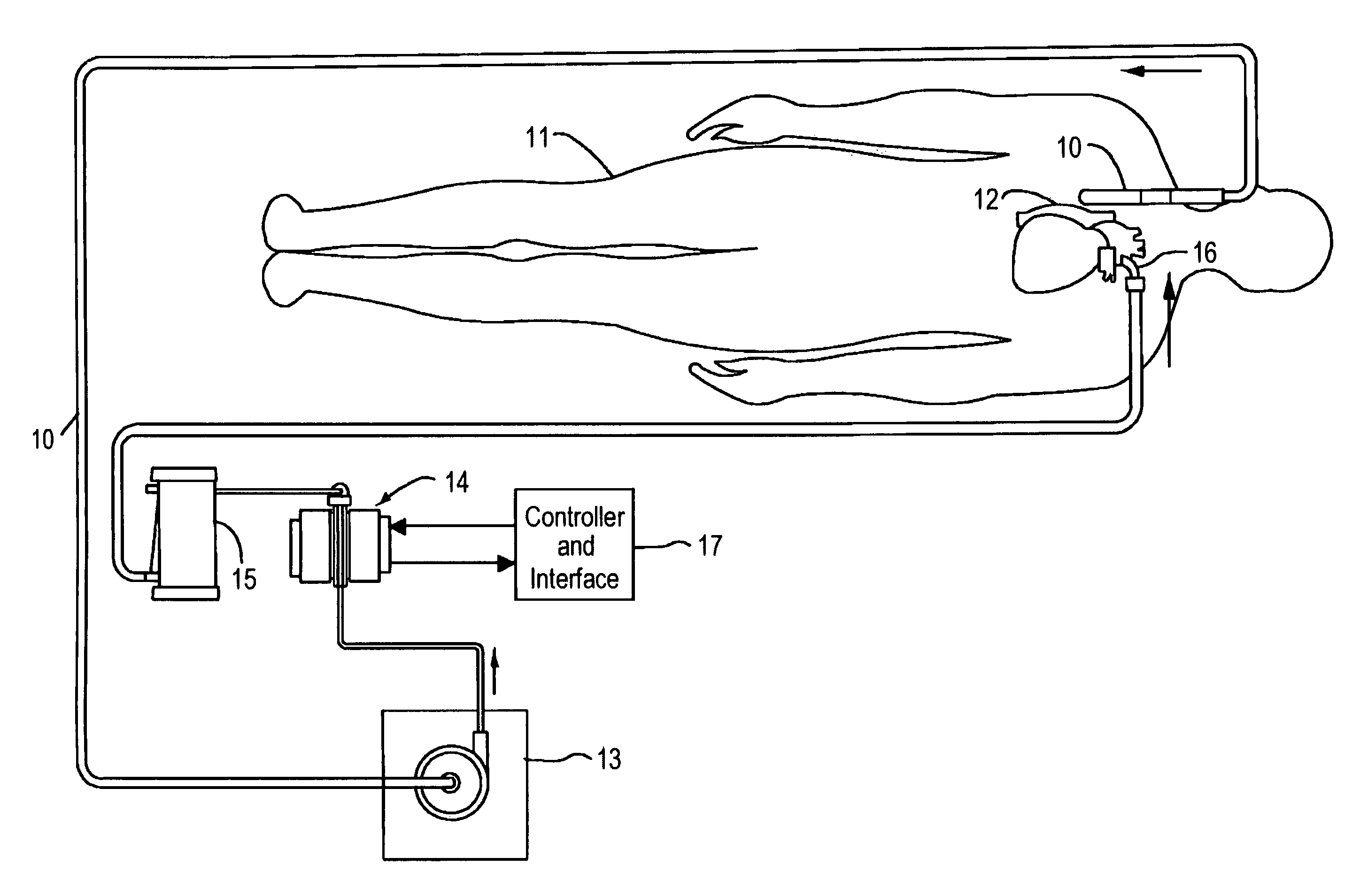 Thermoelectric temperature control for extracorporeal blood circuit