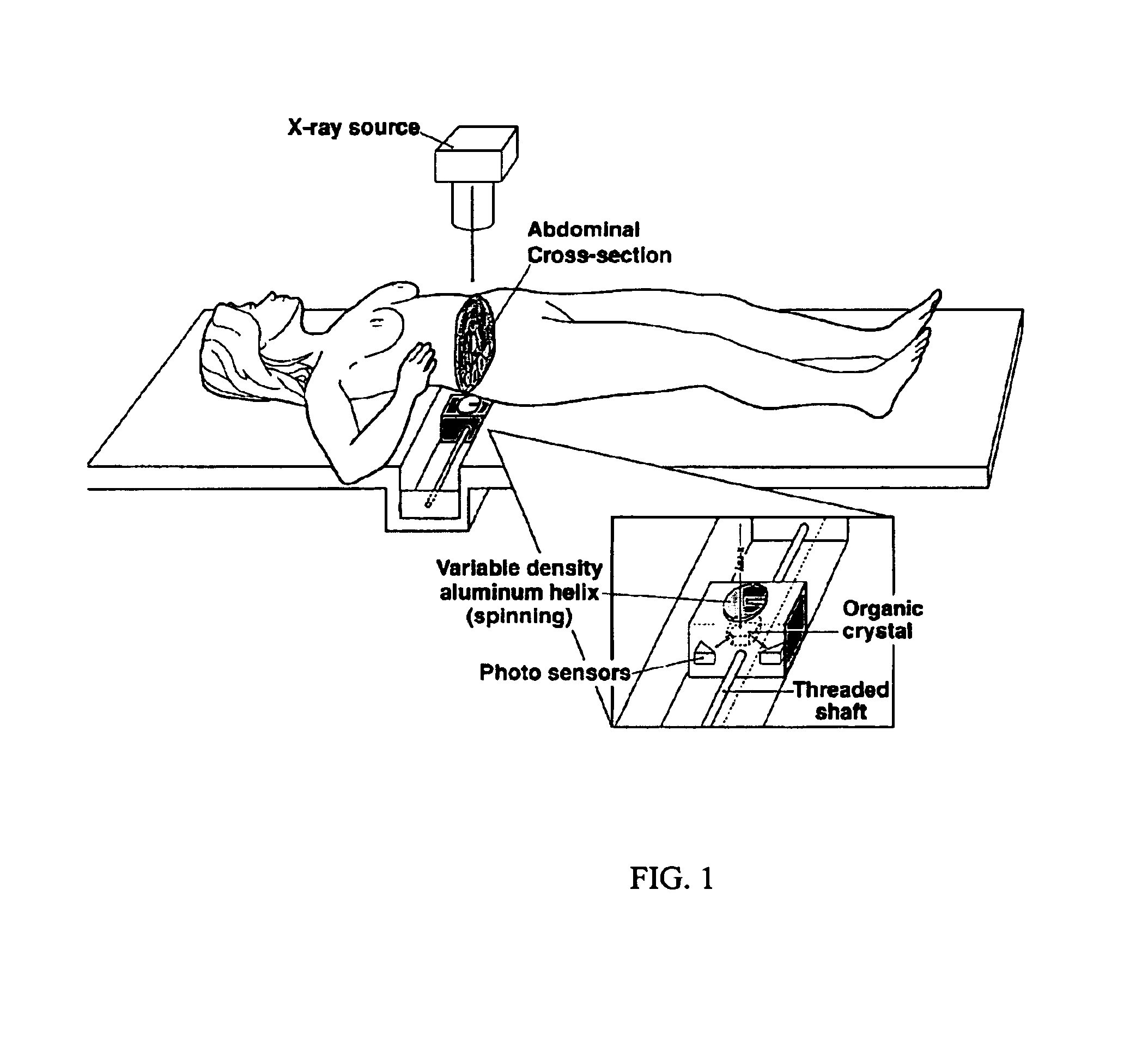 Three component x-ray bone densitometry