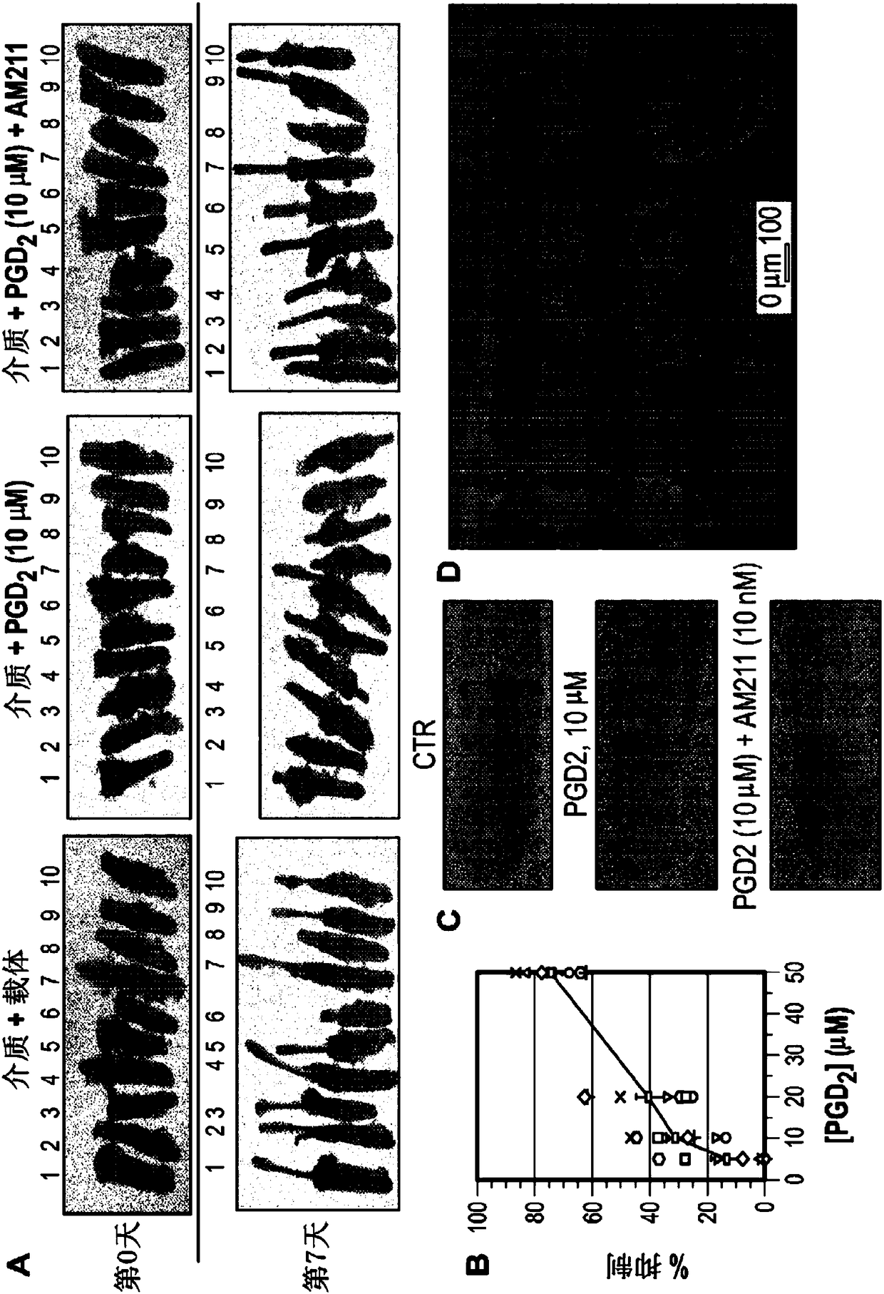 Single nucleotide polymorphic alleles of human dp-2 gene for detection of susceptibility to hair growth inhibition by pgd2