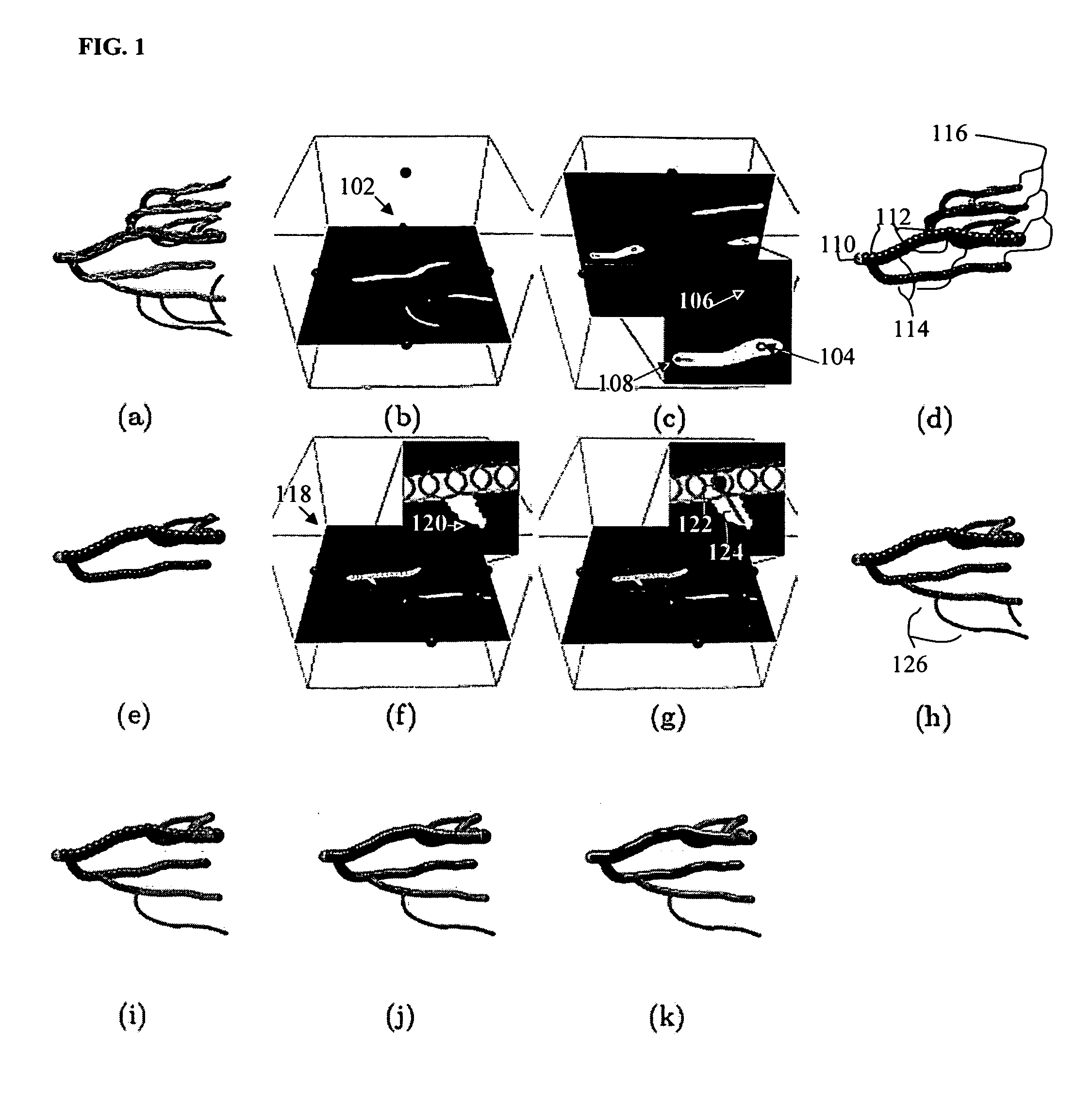 Method and system for segmentation of tubular structures in 3D images