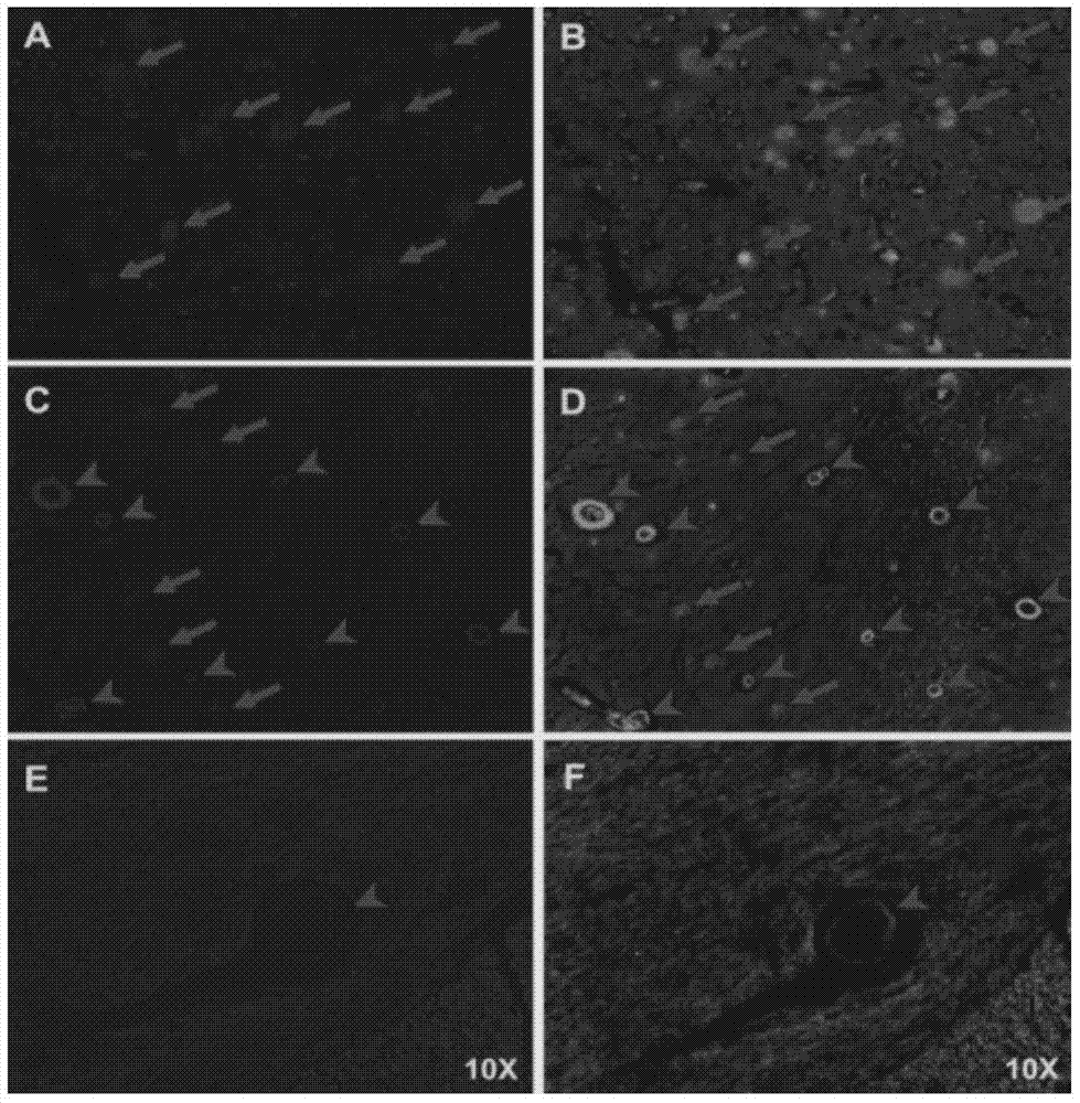 2-aryl benzothiazole compound with high affinity with a(BETA) plaque and preparation method and application thereof