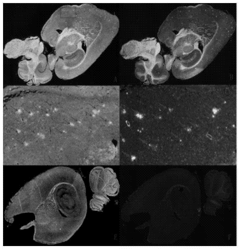 2-aryl benzothiazole compound with high affinity with a(BETA) plaque and preparation method and application thereof