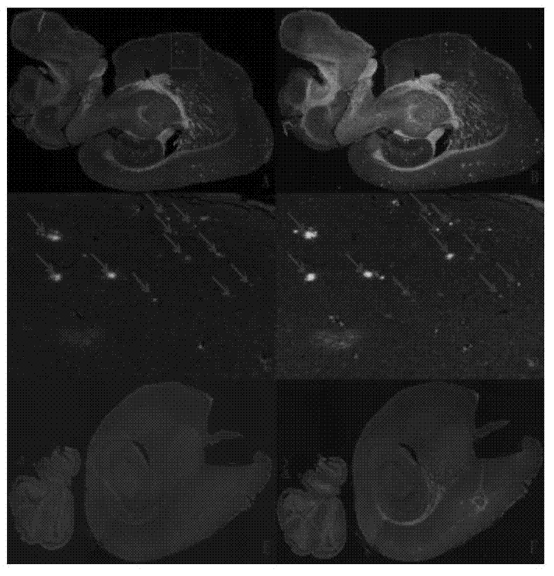 2-aryl benzothiazole compound with high affinity with a(BETA) plaque and preparation method and application thereof