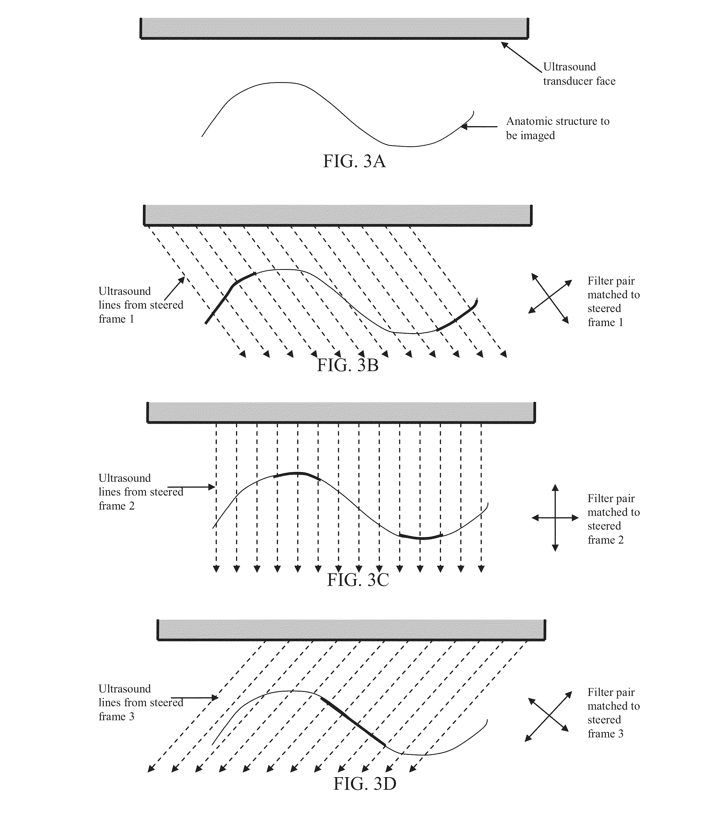 Component Frame Enhancement for Spatial Compounding in Ultrasound Imaging