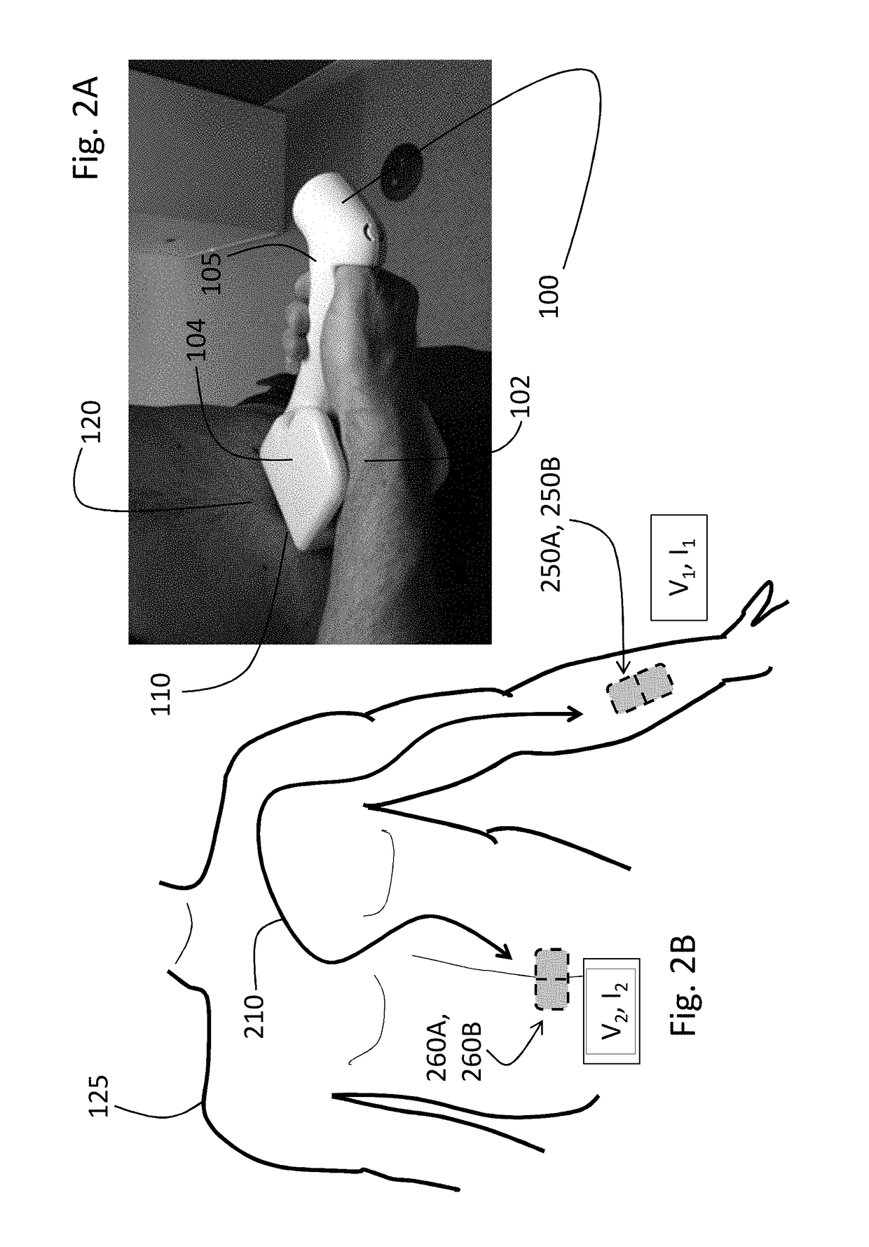 Handheld physiological sensor