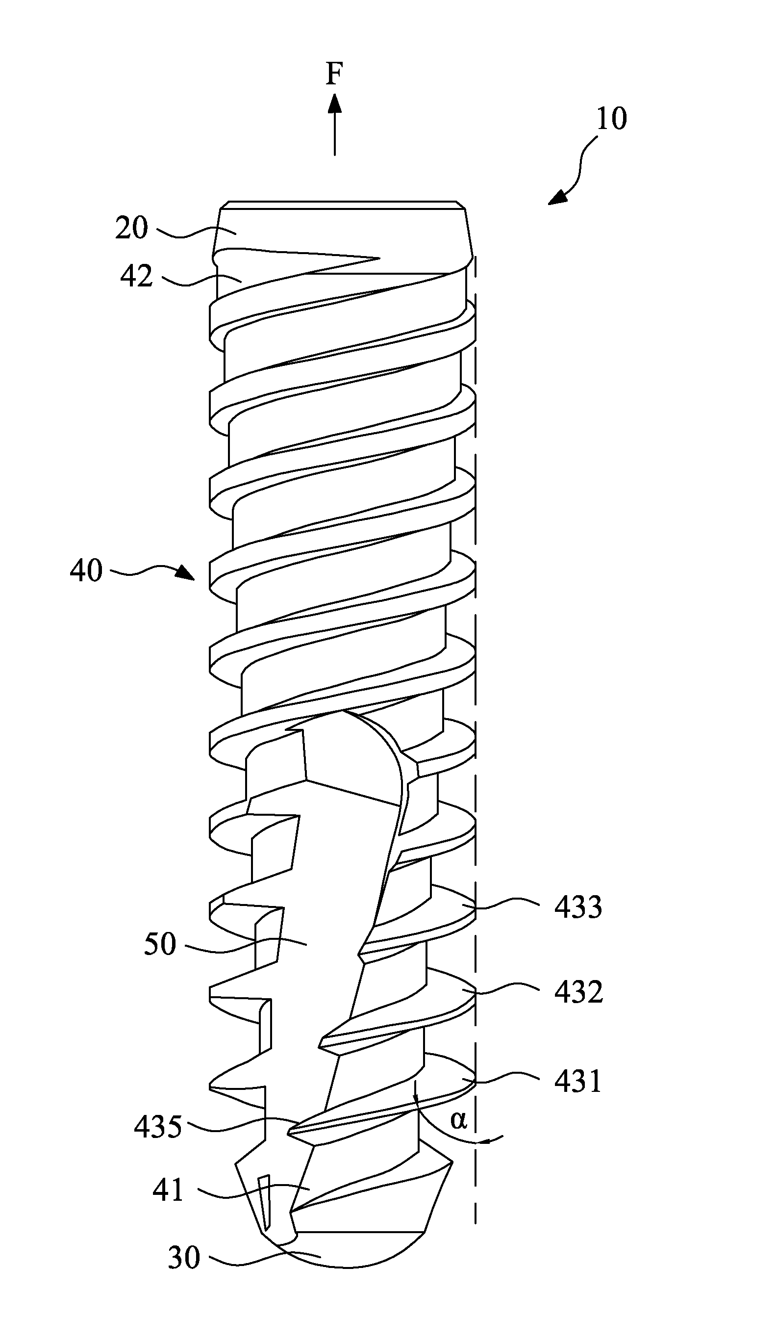 Dental implant