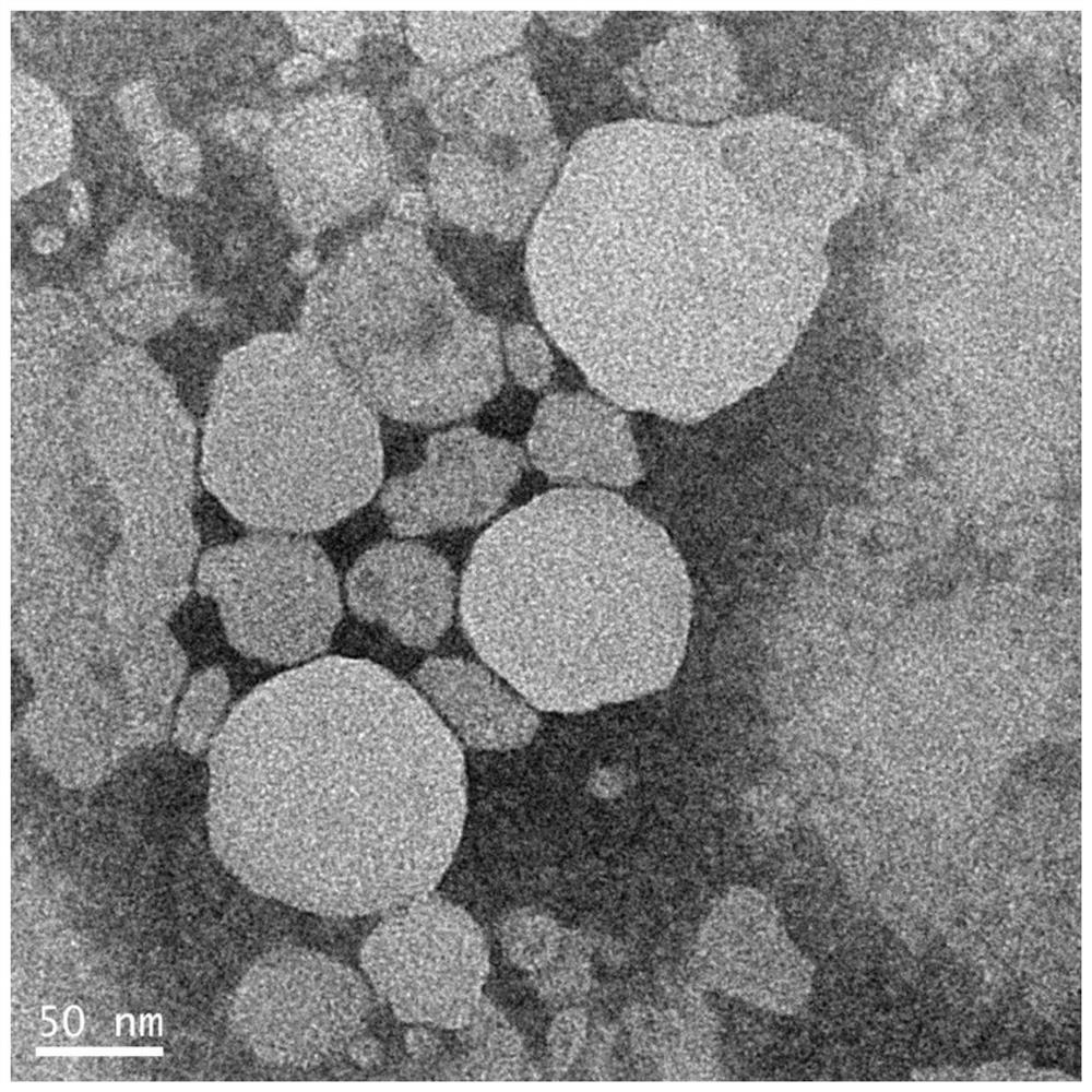 Fat emulsion dialysate as well as preparation method and application thereof