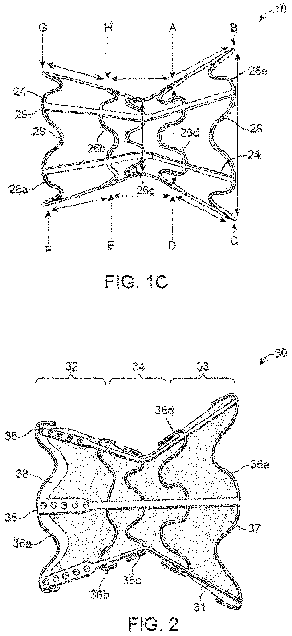 Asymmetric shunt for redistributing atrial blood volume