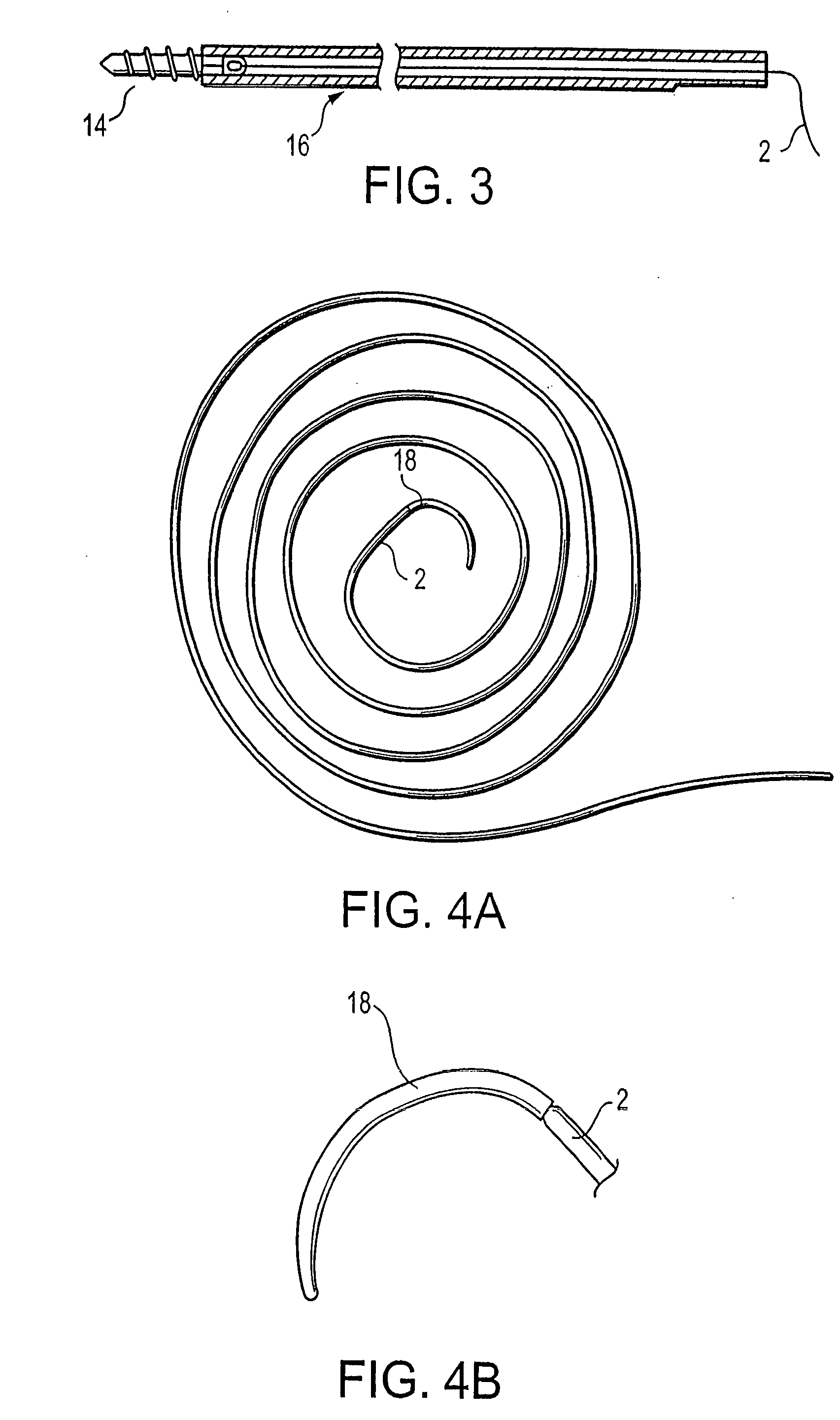 High strength suture with UHMWPE and polybutester