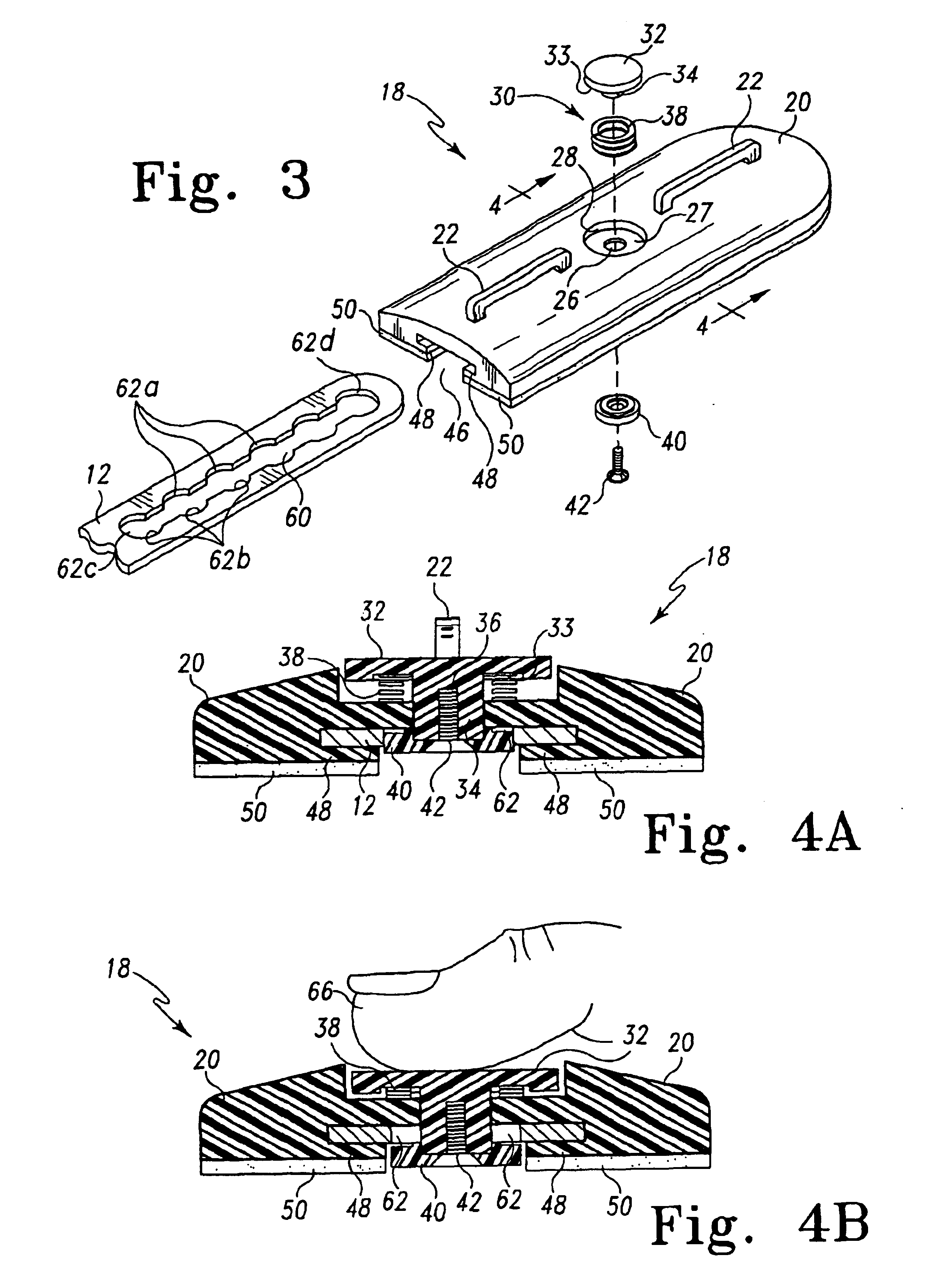 Orthopaedic brace having a range of motion hinge with an adjustable-length strut