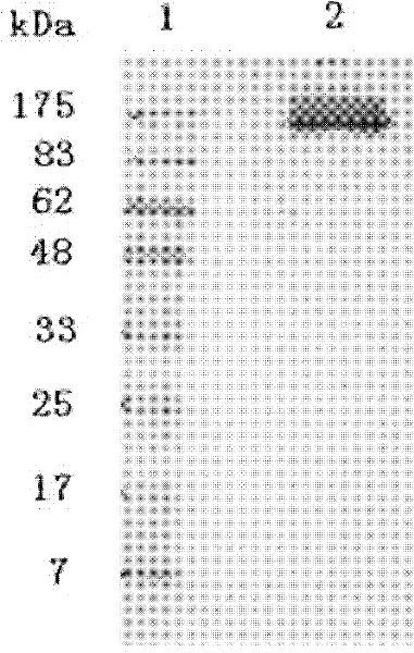 Purification method of F protein of human respiratory syncytial virus