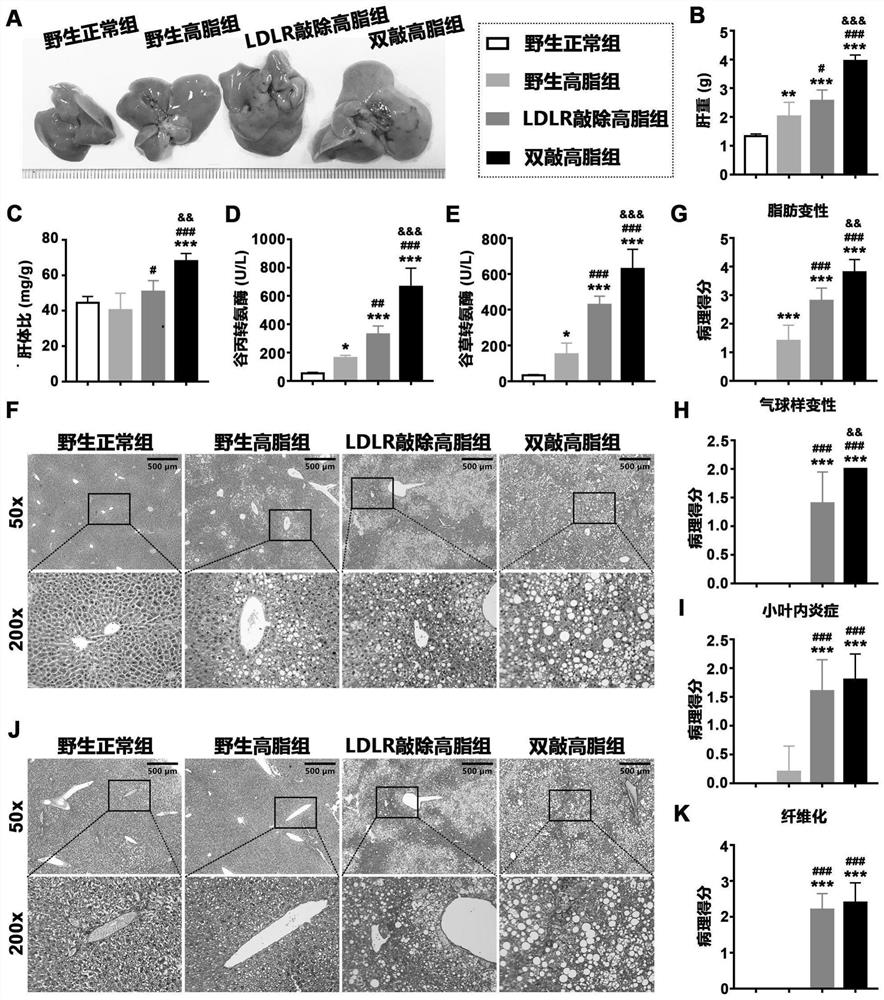 Construction method and application of non-alcoholic steatohepatitis mouse model based on PEDF/LDLR double-gene knockout
