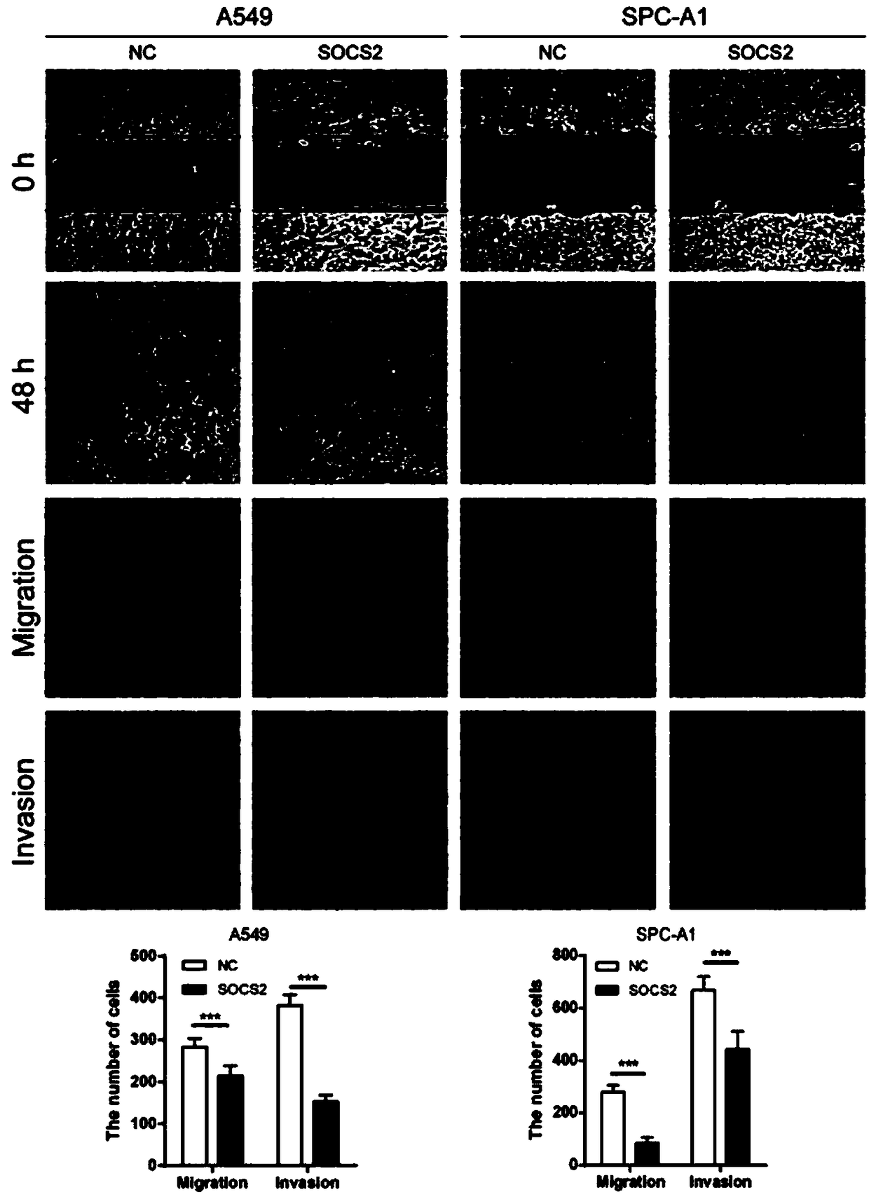 Applications of suppressor of eytokine signaling 2