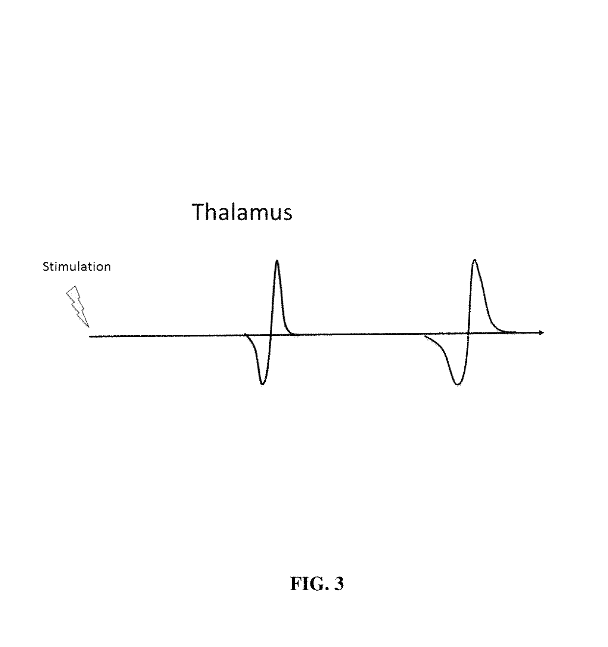 Method and system for physiological target localization from macroelectrode recordings and monitoring spinal cord function