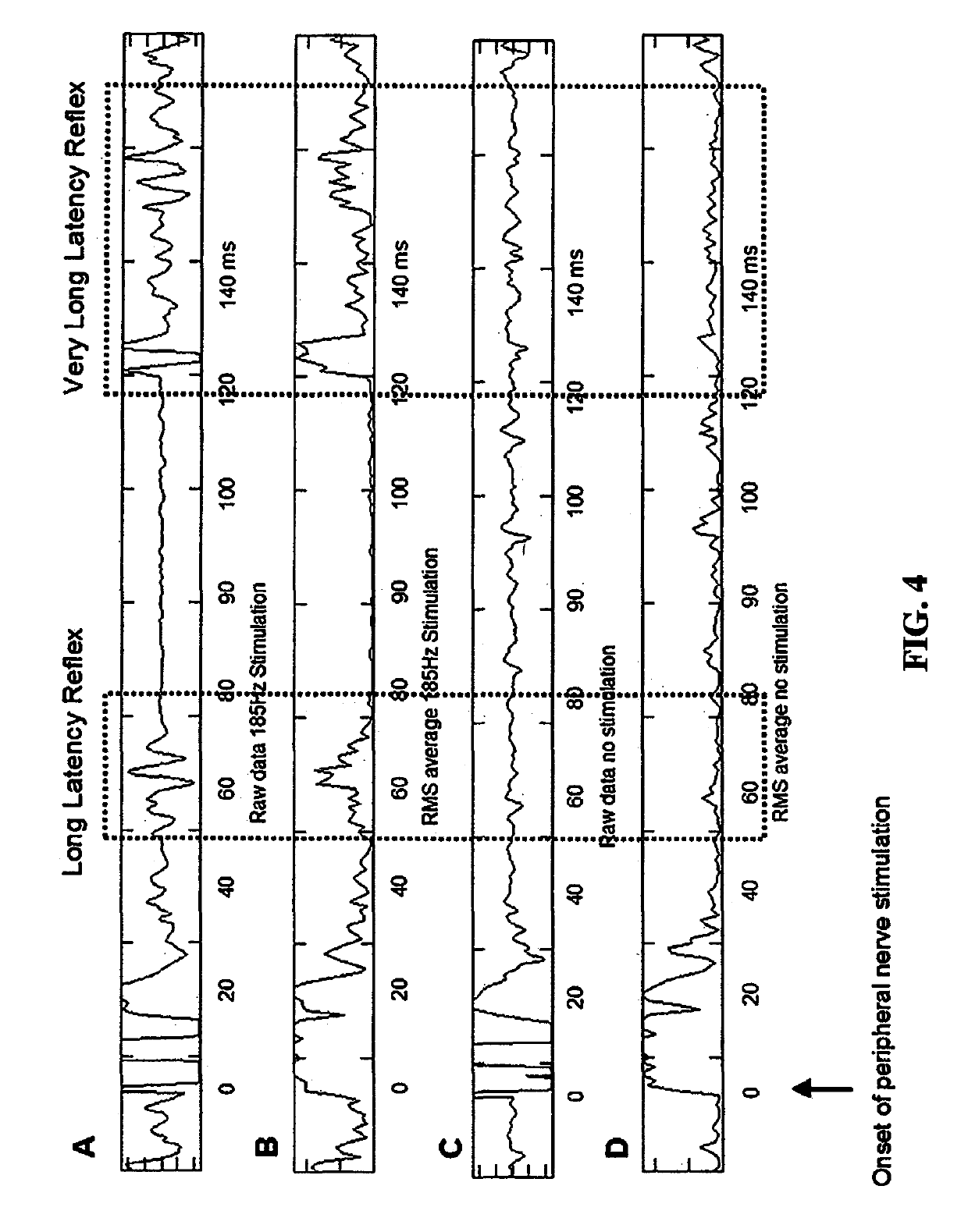 Method and system for physiological target localization from macroelectrode recordings and monitoring spinal cord function