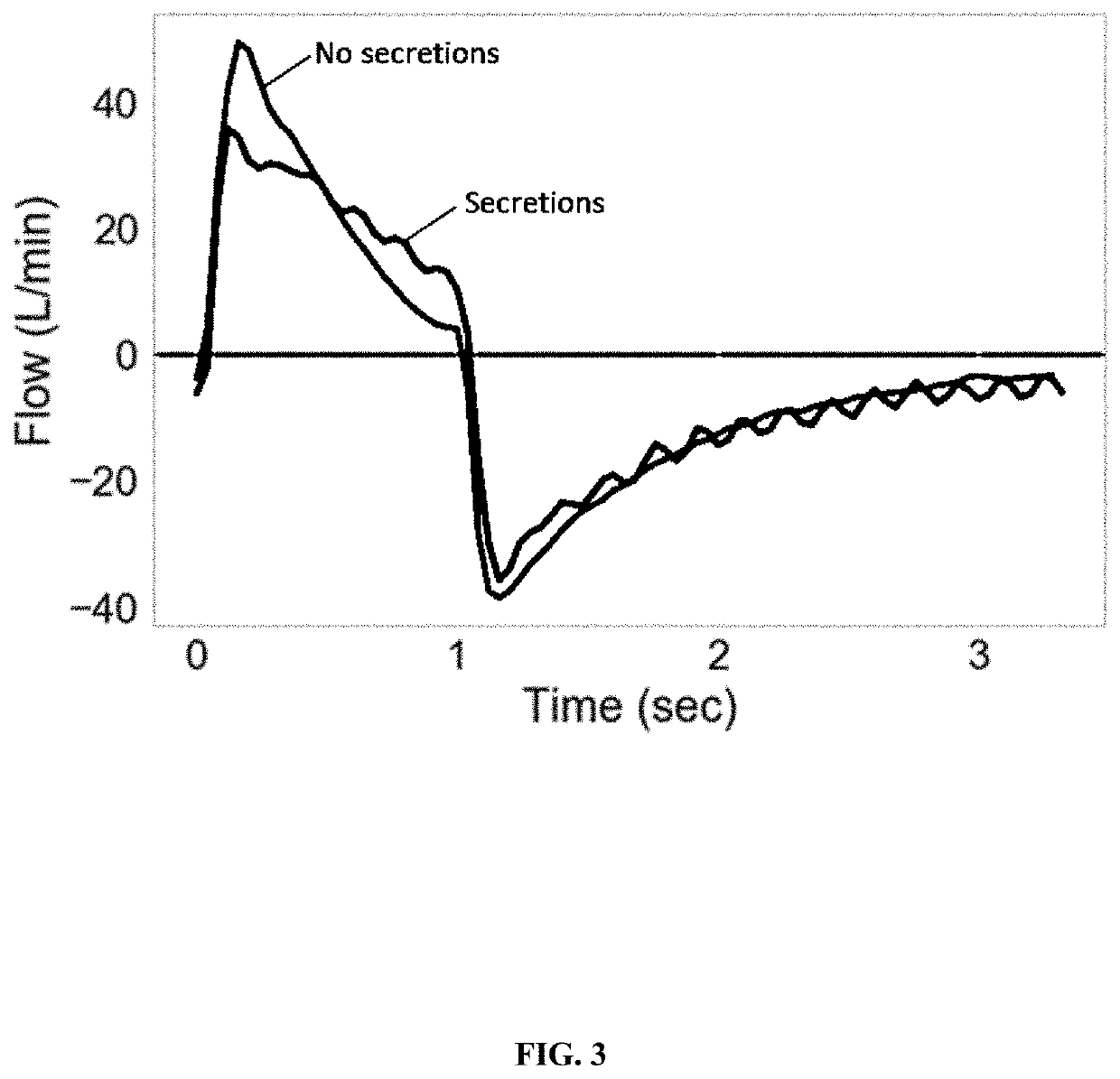 Clinical Decision Support System for Patient-Ventilator Asynchrony Detection and Management