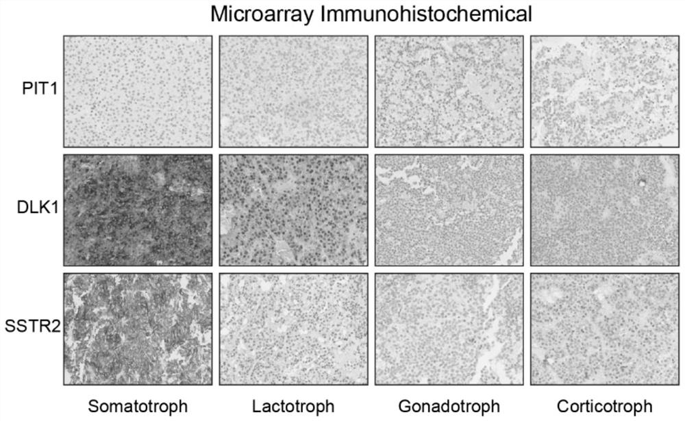 Application of DLK1/MEG3 locus in detection and treatment of growth hormone adenoma