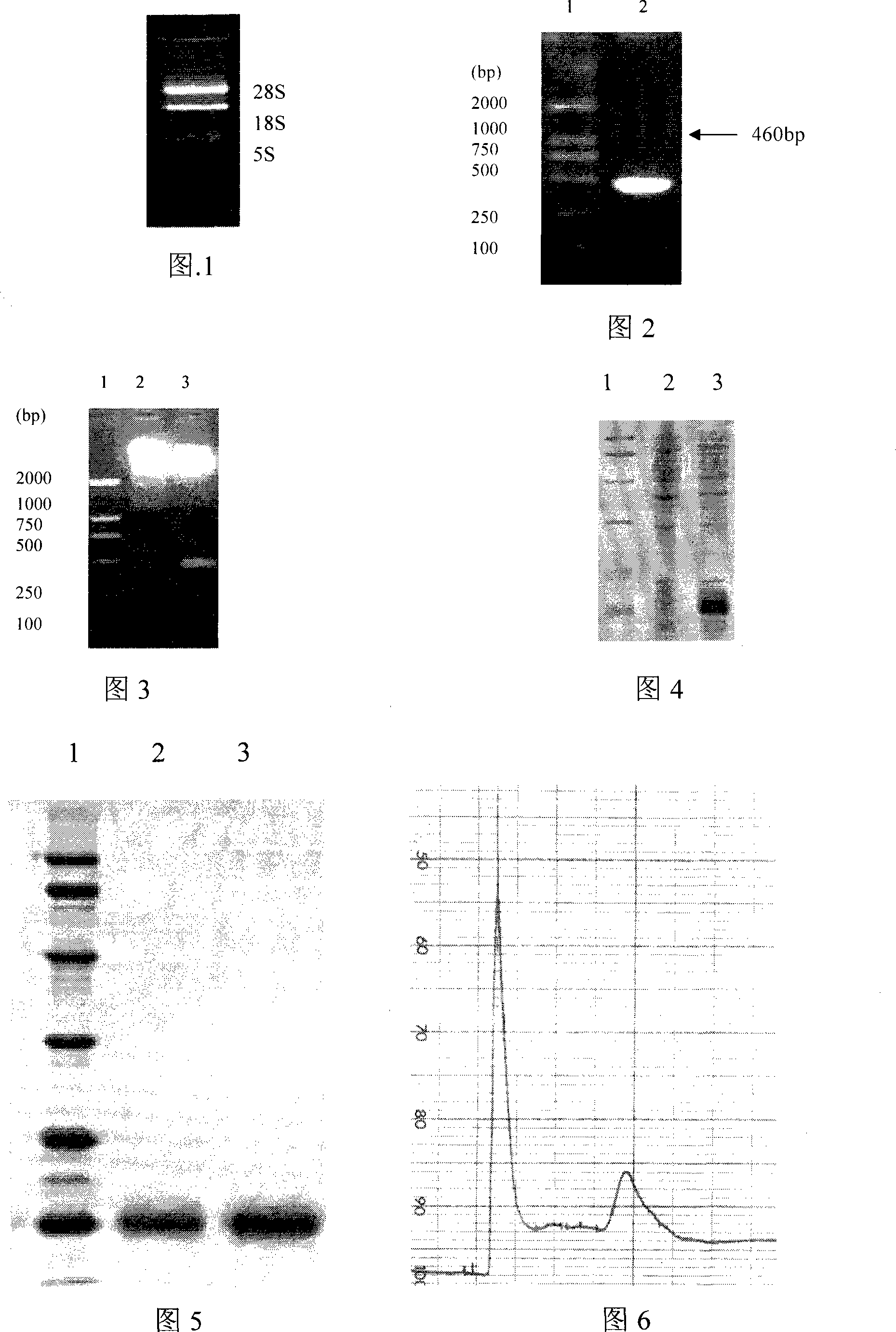 Application of interleukin-22 in preparing medicine for treating hepatopathy and preparation method thereof