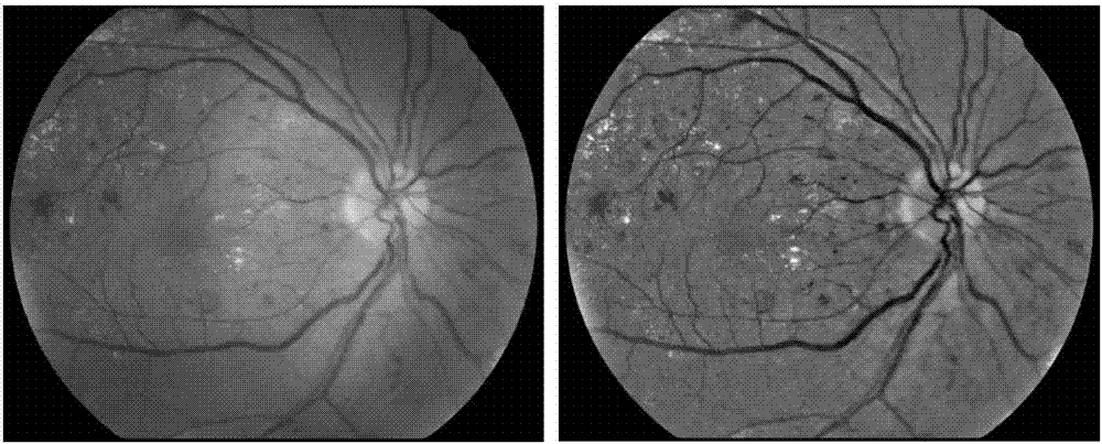 Eye fundus image quality control method