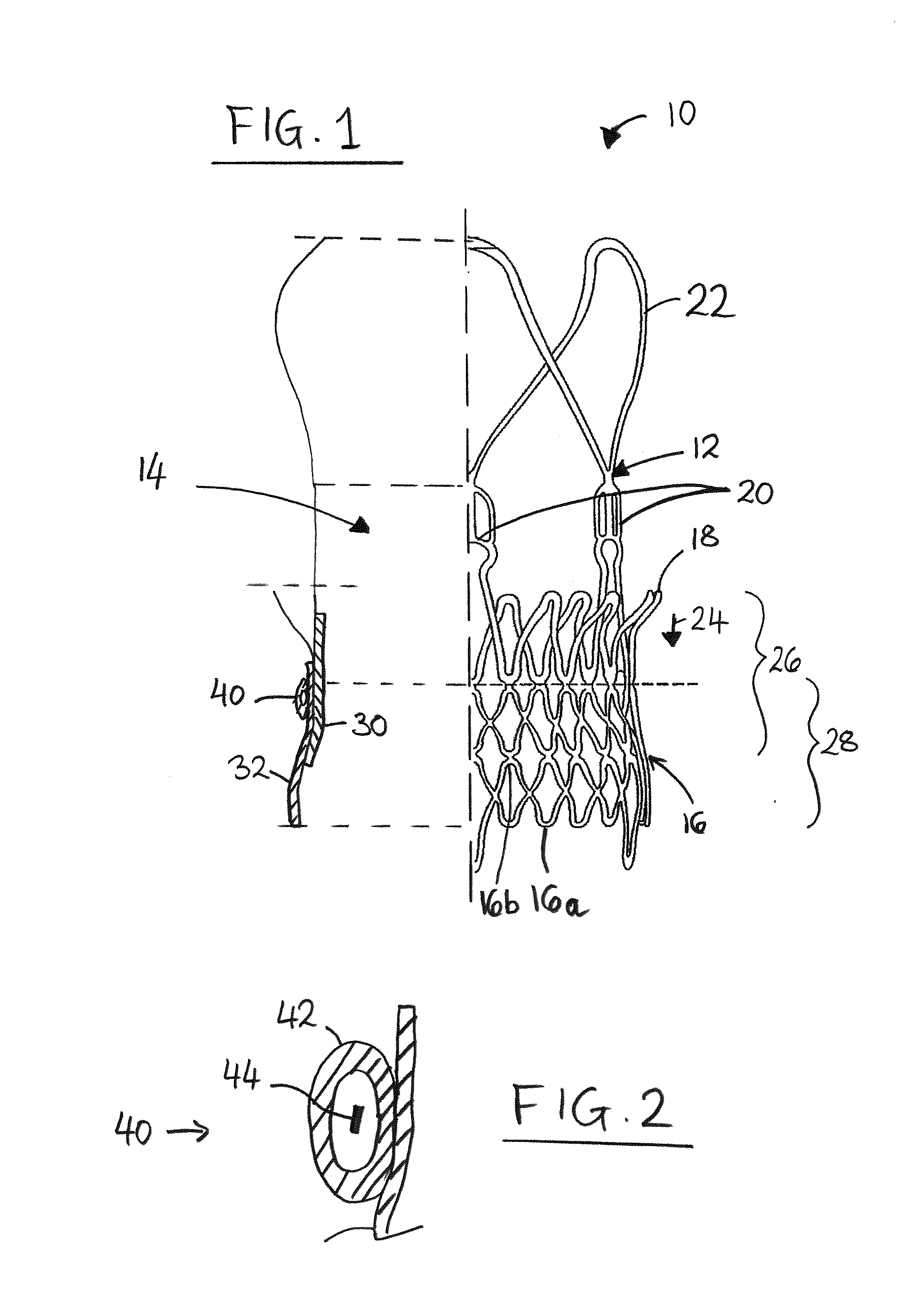 Prosthesis seals and methods for sealing an expandable prosthesis