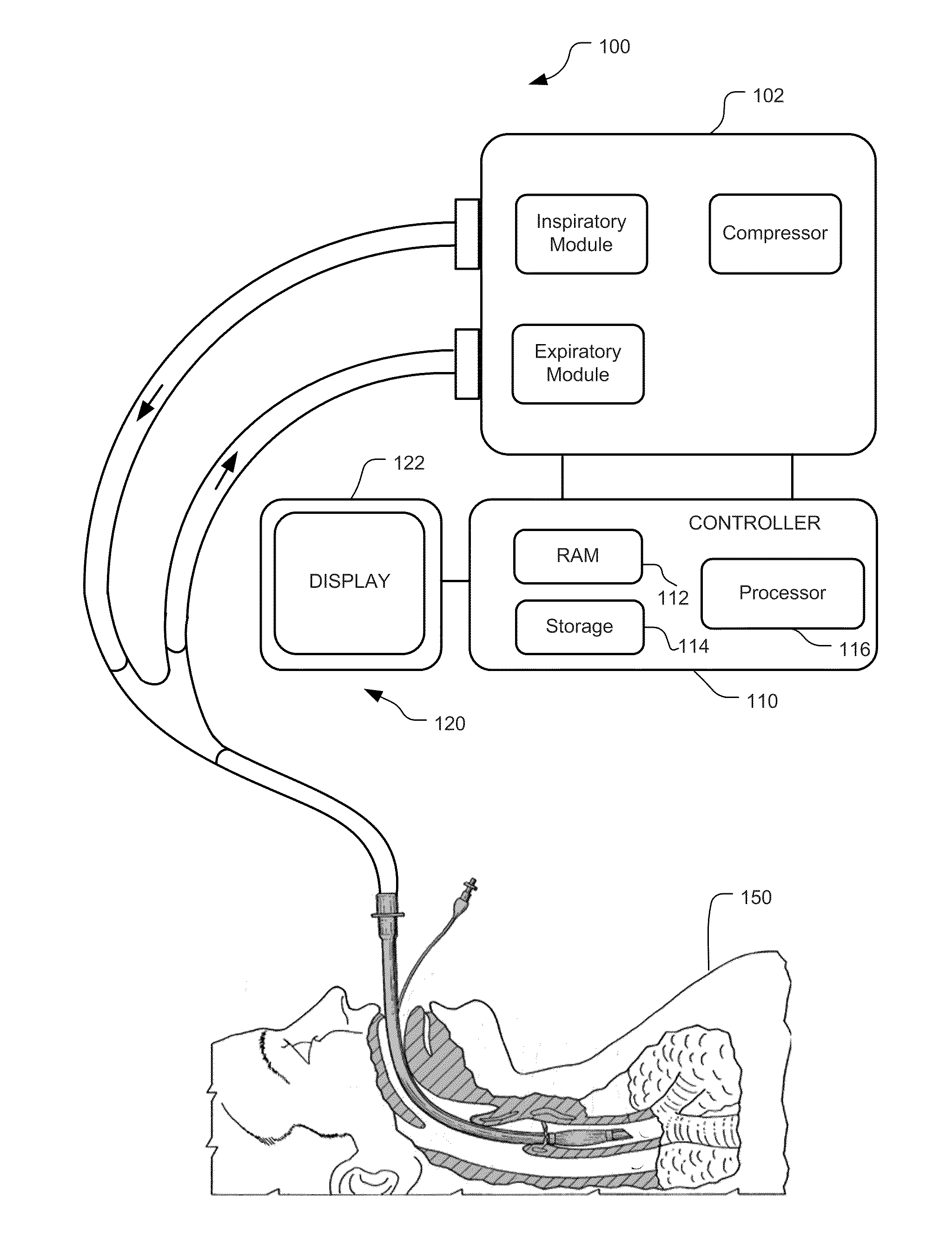 Visual Indication Of Alarms On A Ventilator Graphical User Interface