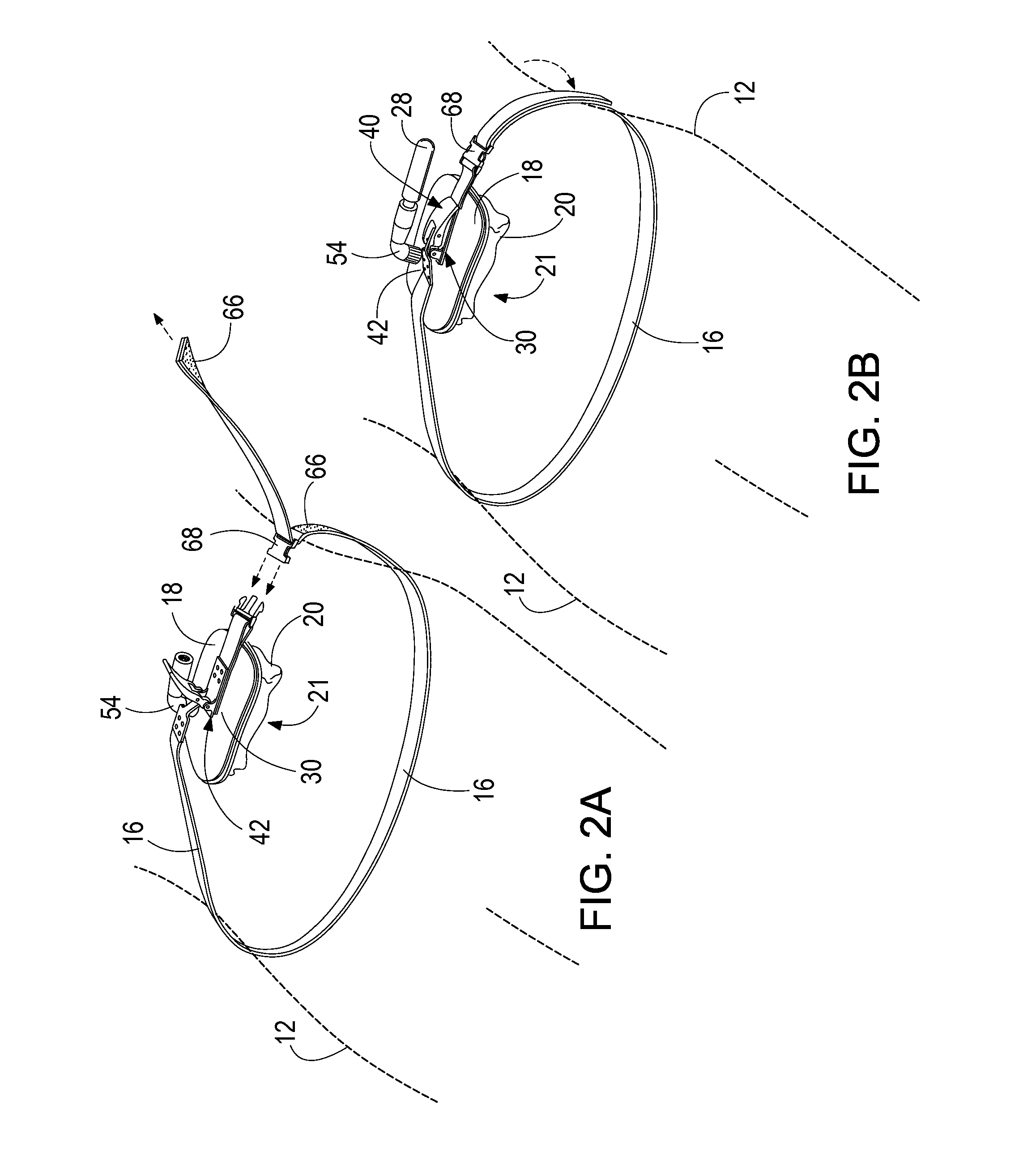 Portable pneumatic abdominal aortic tourniquet with supplemental tensioning means