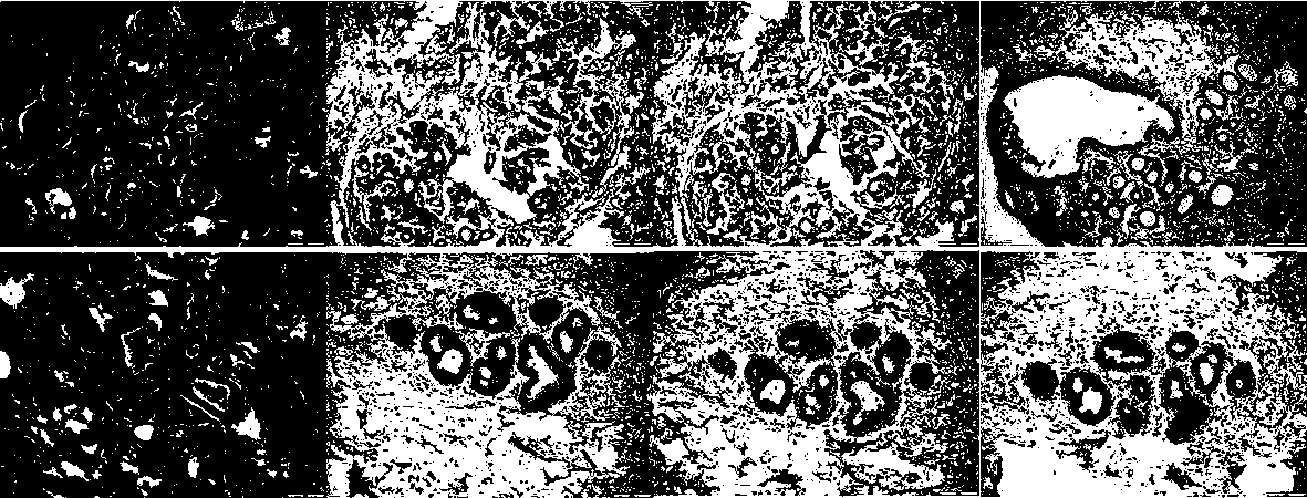 Fixation treatment method for in-vitro breast cancer axillary lymph node tissue specimen