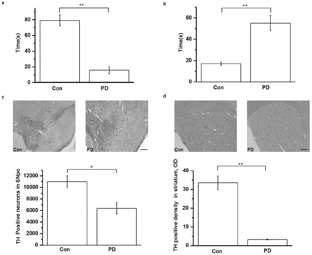 Application of Nedd4-2 to parkinson's disease treatment