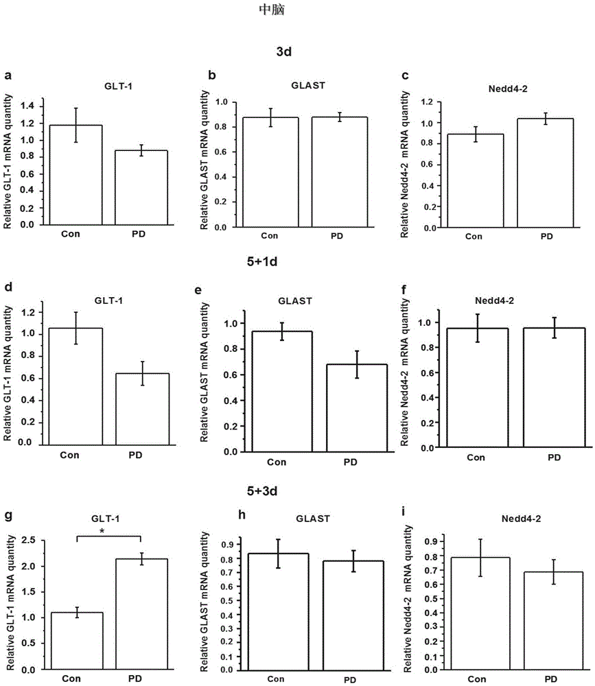 Application of Nedd4-2 to parkinson's disease treatment