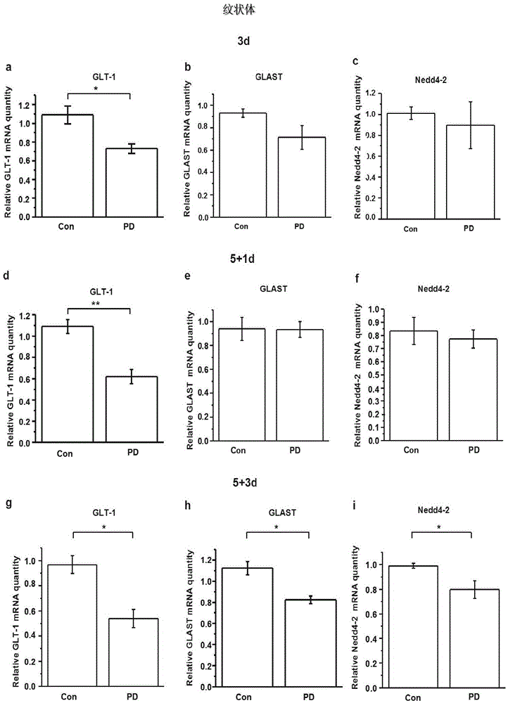 Application of Nedd4-2 to parkinson's disease treatment