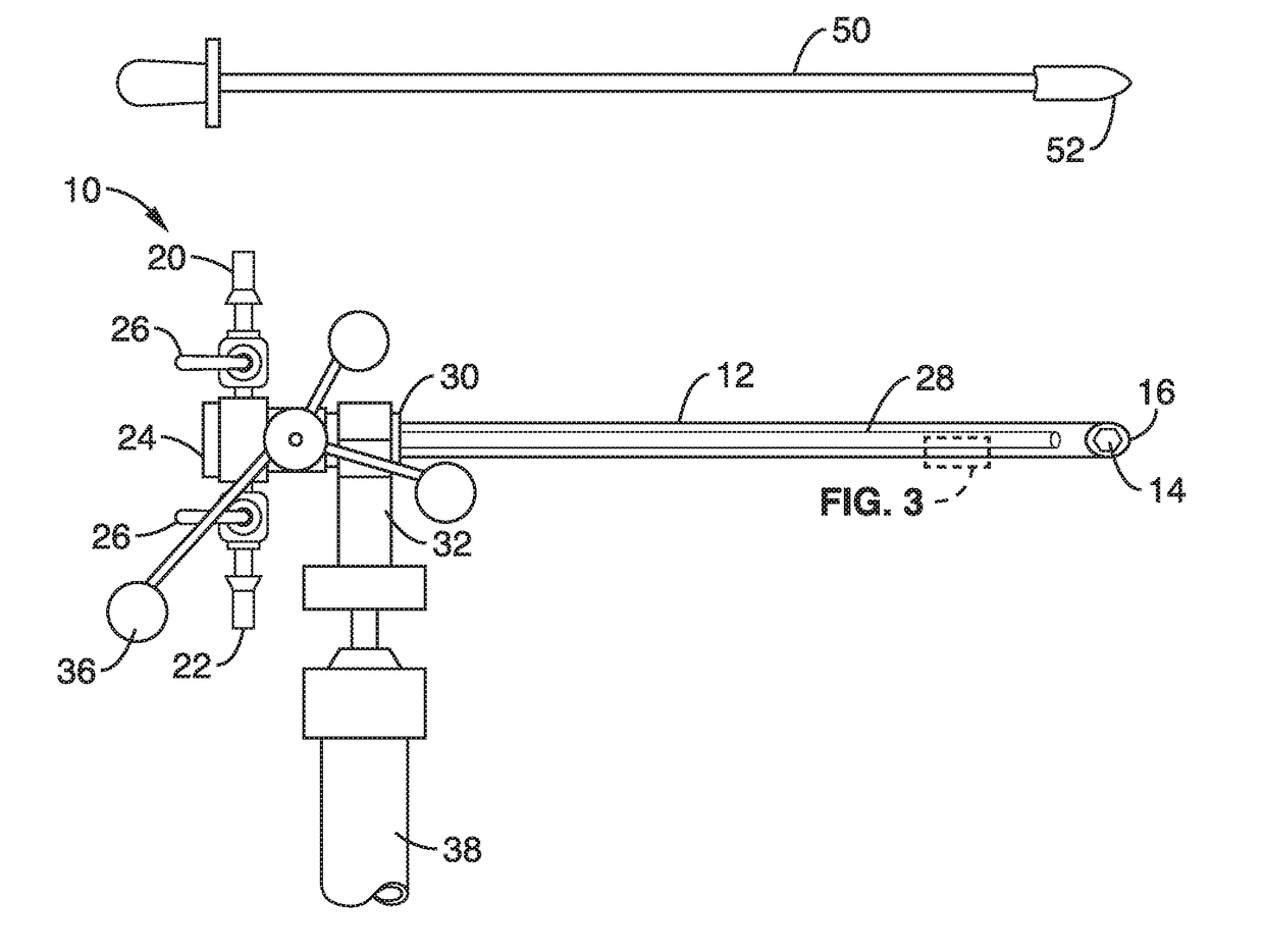 Image-guided irrigating suction cannula for removal of intracerebral hemorrhage and other lesions