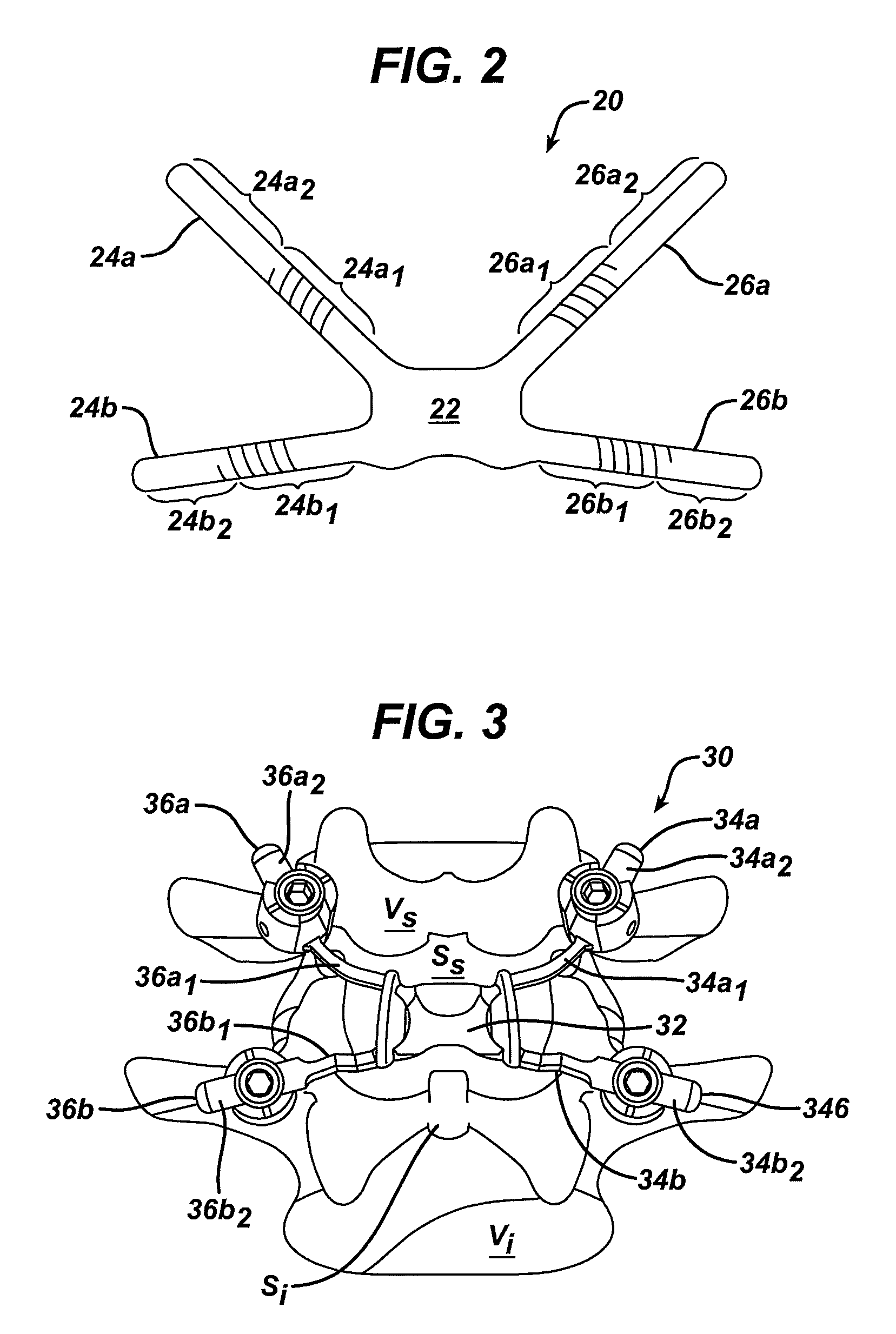 Posterior dynamic stabilization x-device