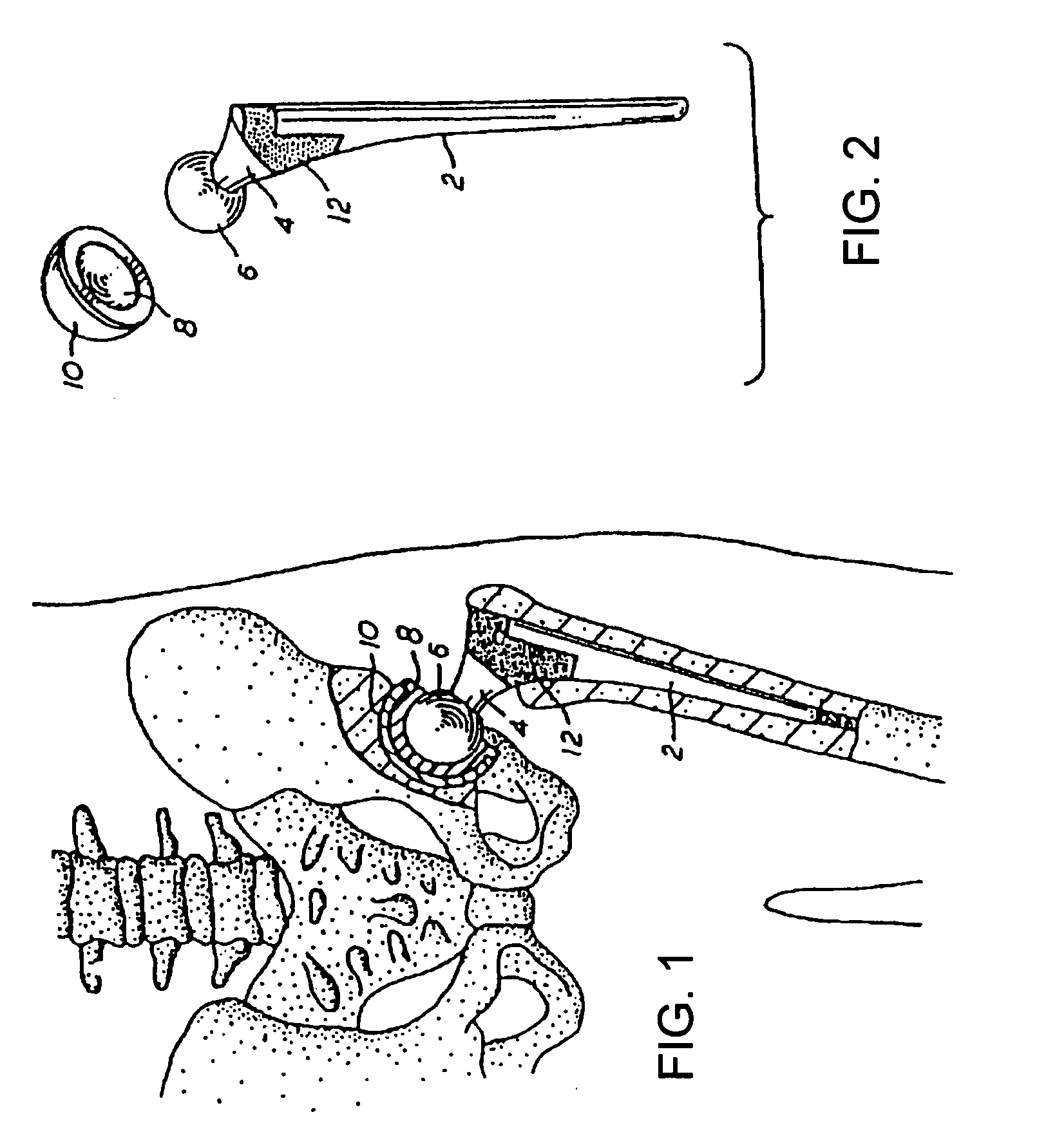 Method of surface oxidizing zirconium and zirconium alloys and resulting product