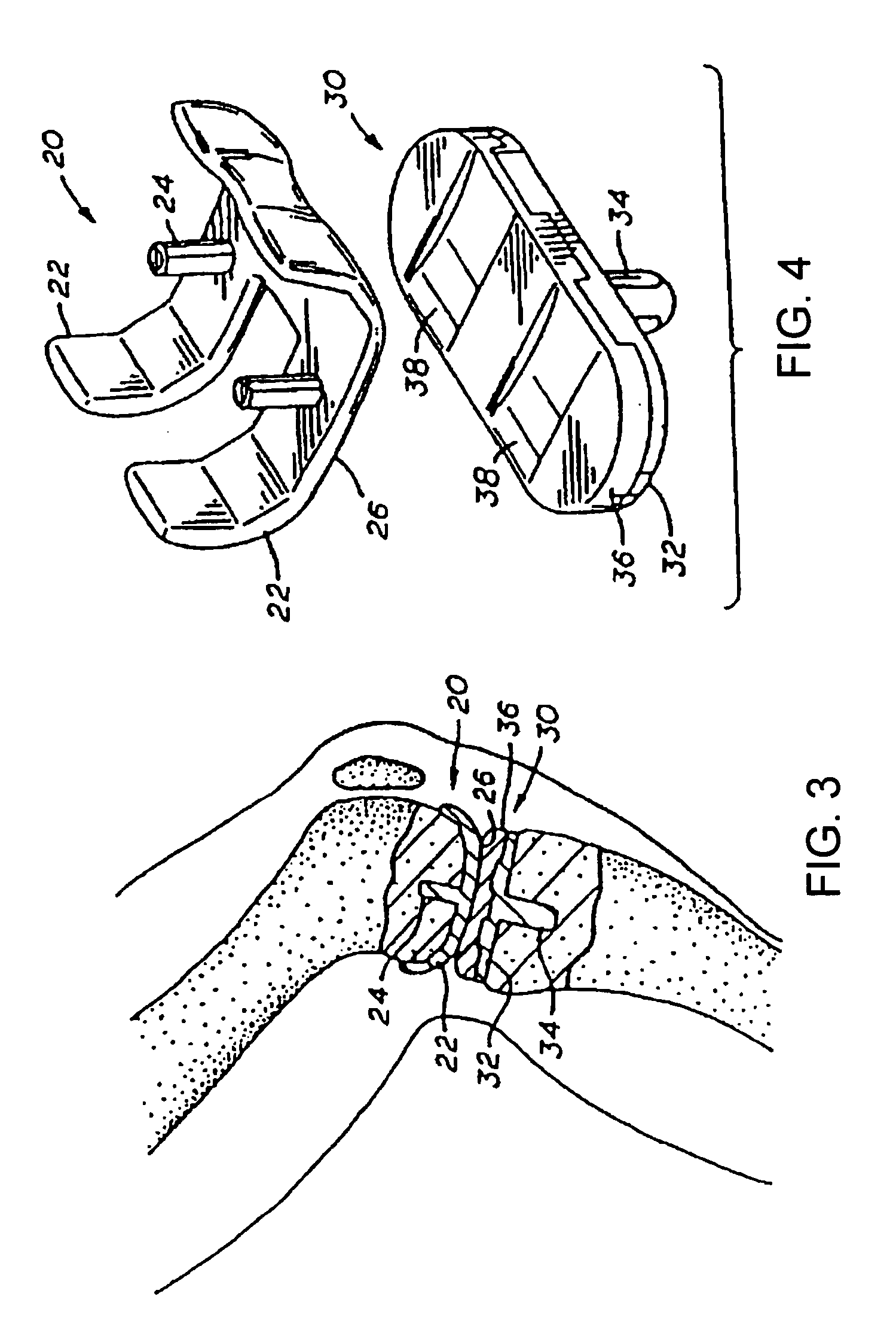 Method of surface oxidizing zirconium and zirconium alloys and resulting product