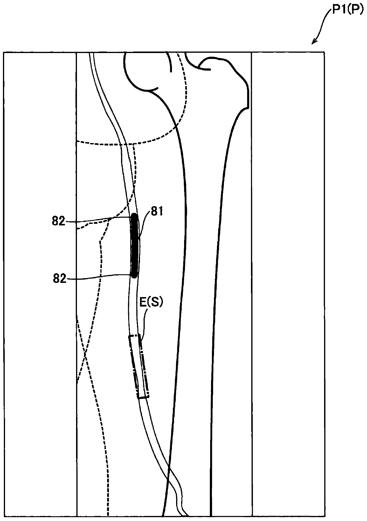 Radiographic imaging apparatus