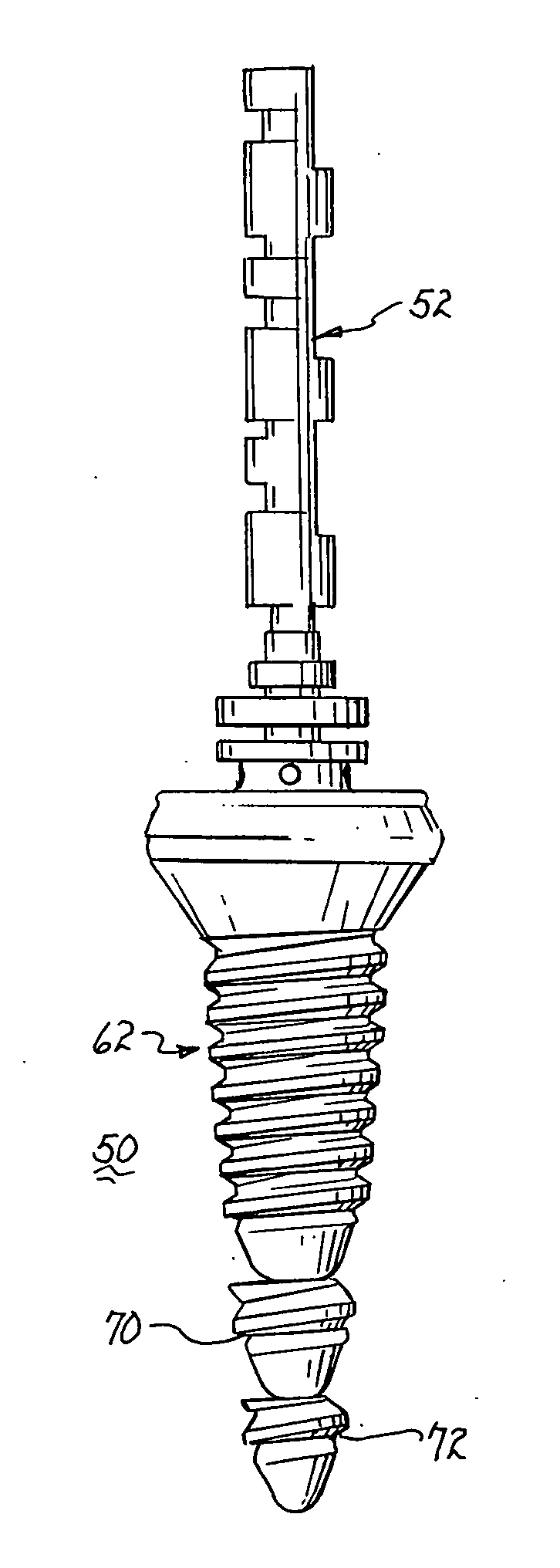 Dental implant