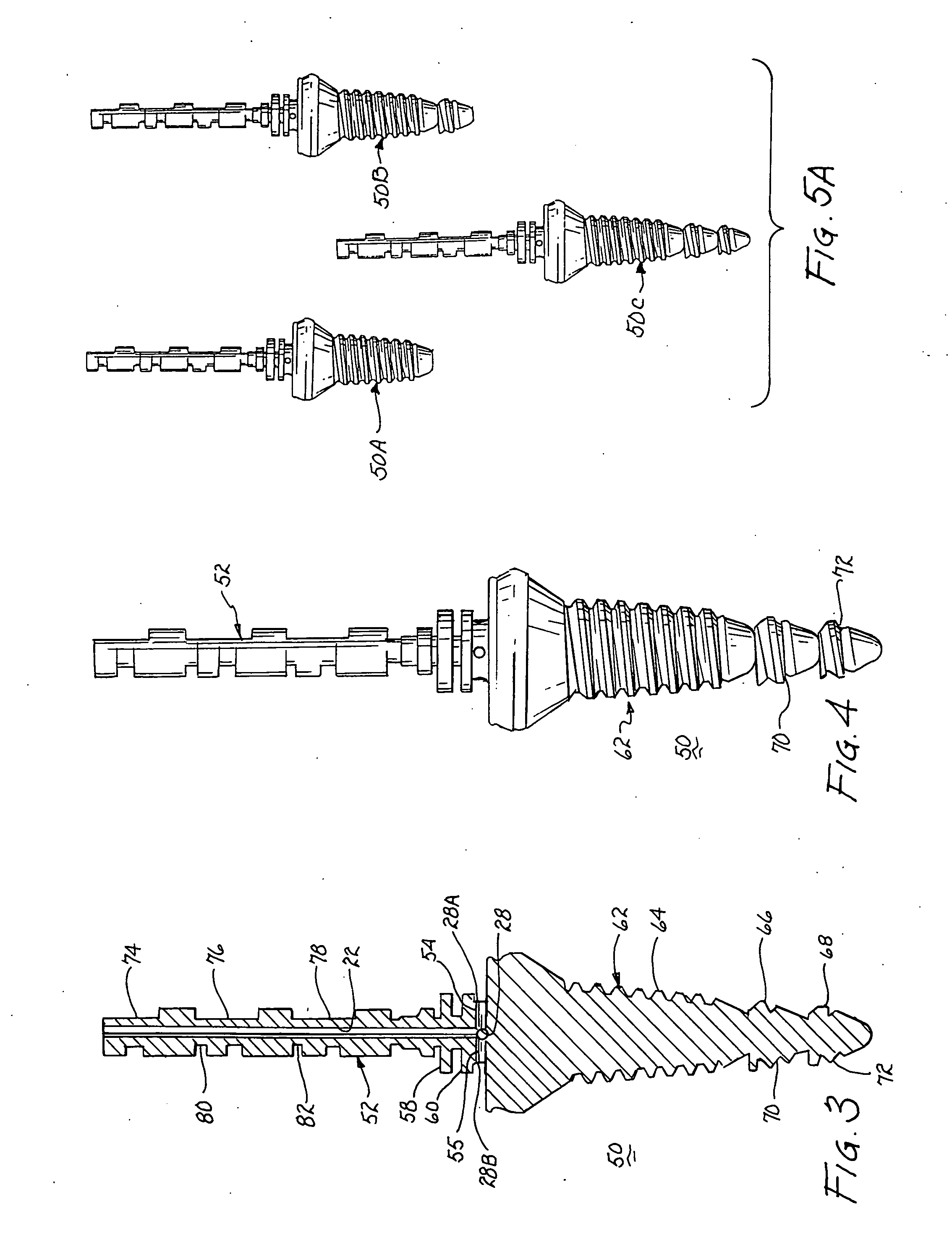 Dental implant