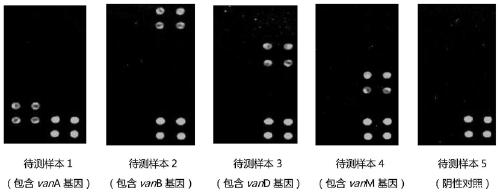 Specific primer combination and probe combination for detecting four glycopeptide drug resistance genes in enterococcus bacteria and application thereof