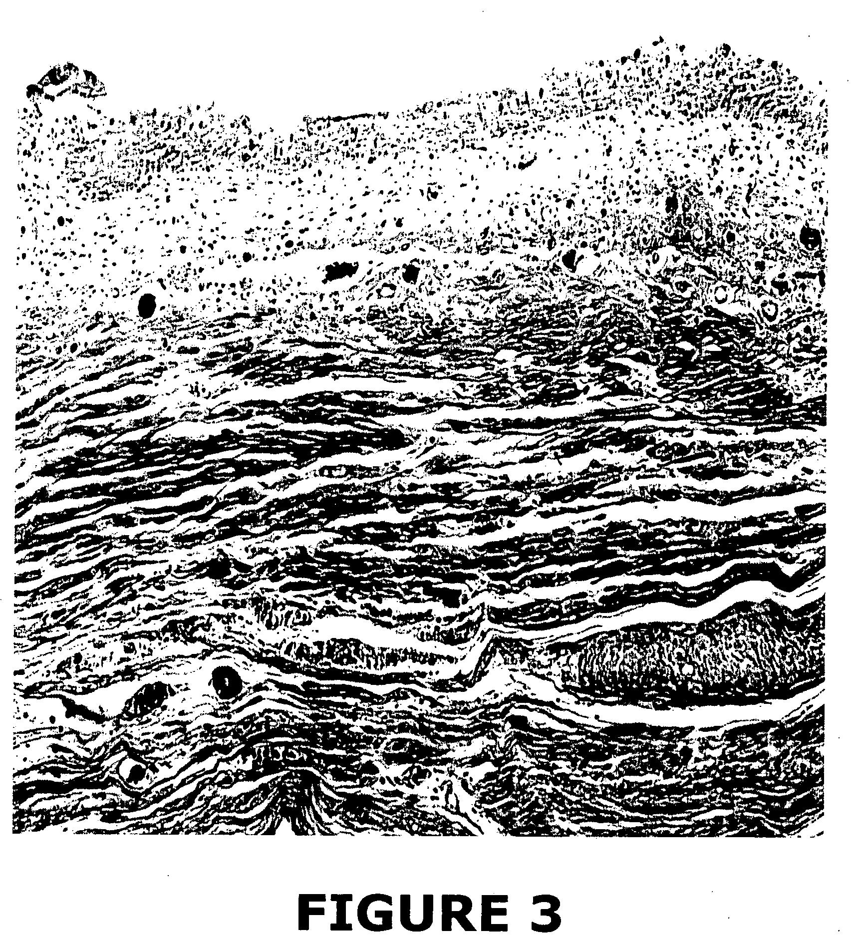 Tissue graft compositions and methods for producing same