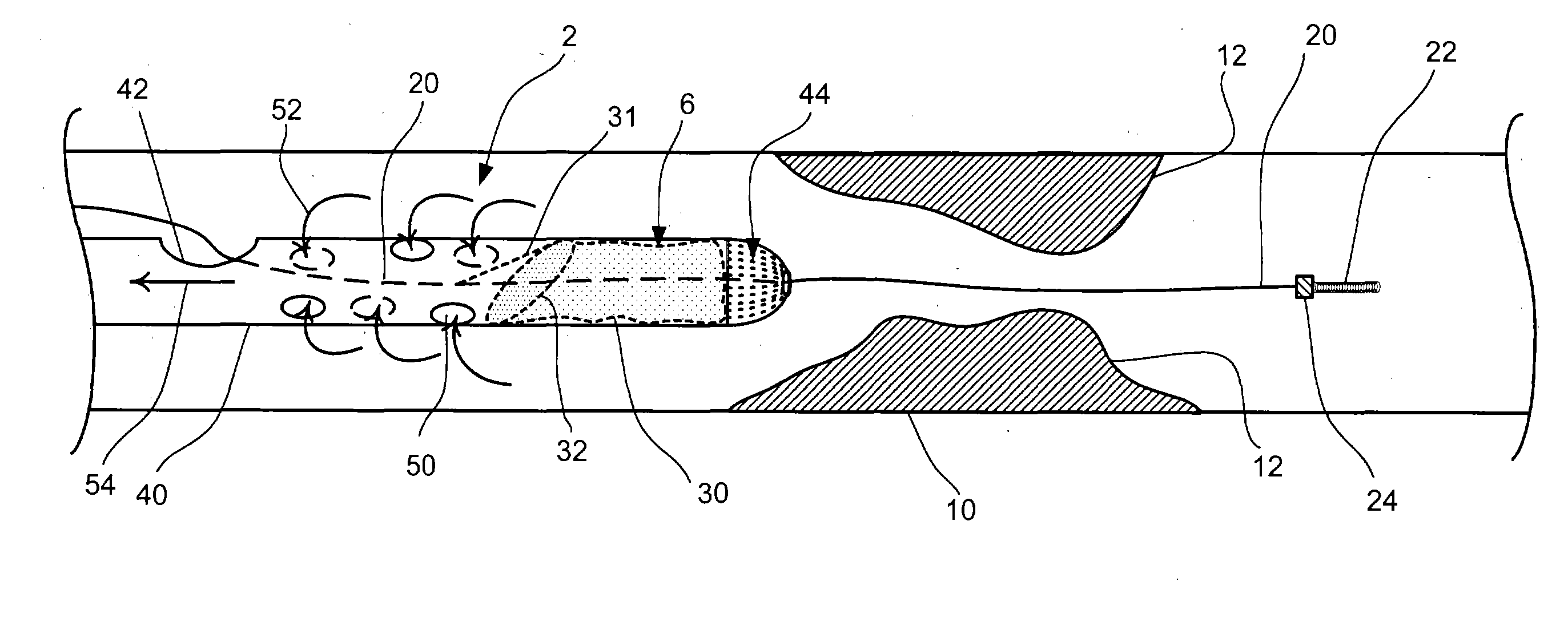 Embolic protection aspirator