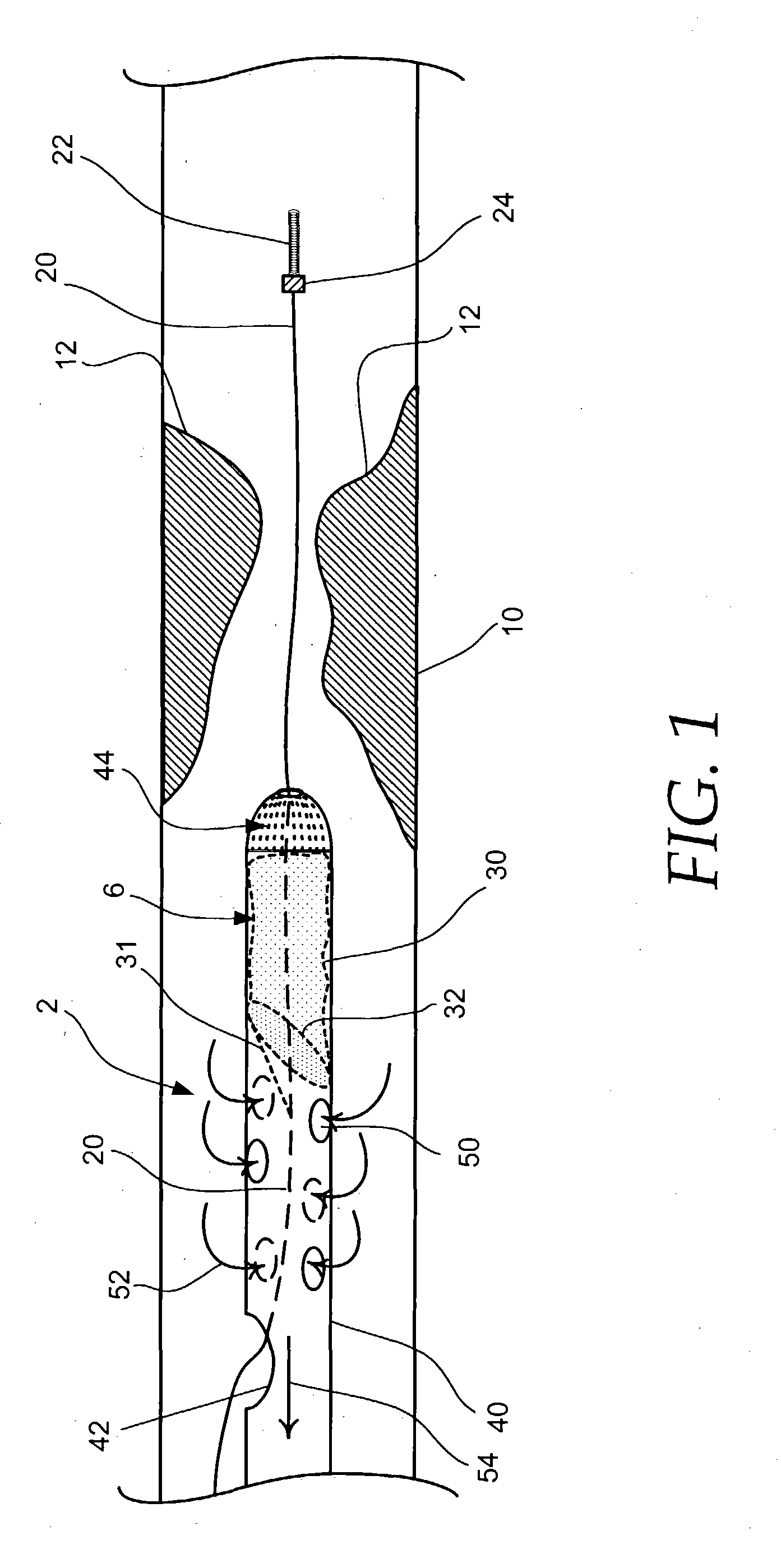 Embolic protection aspirator