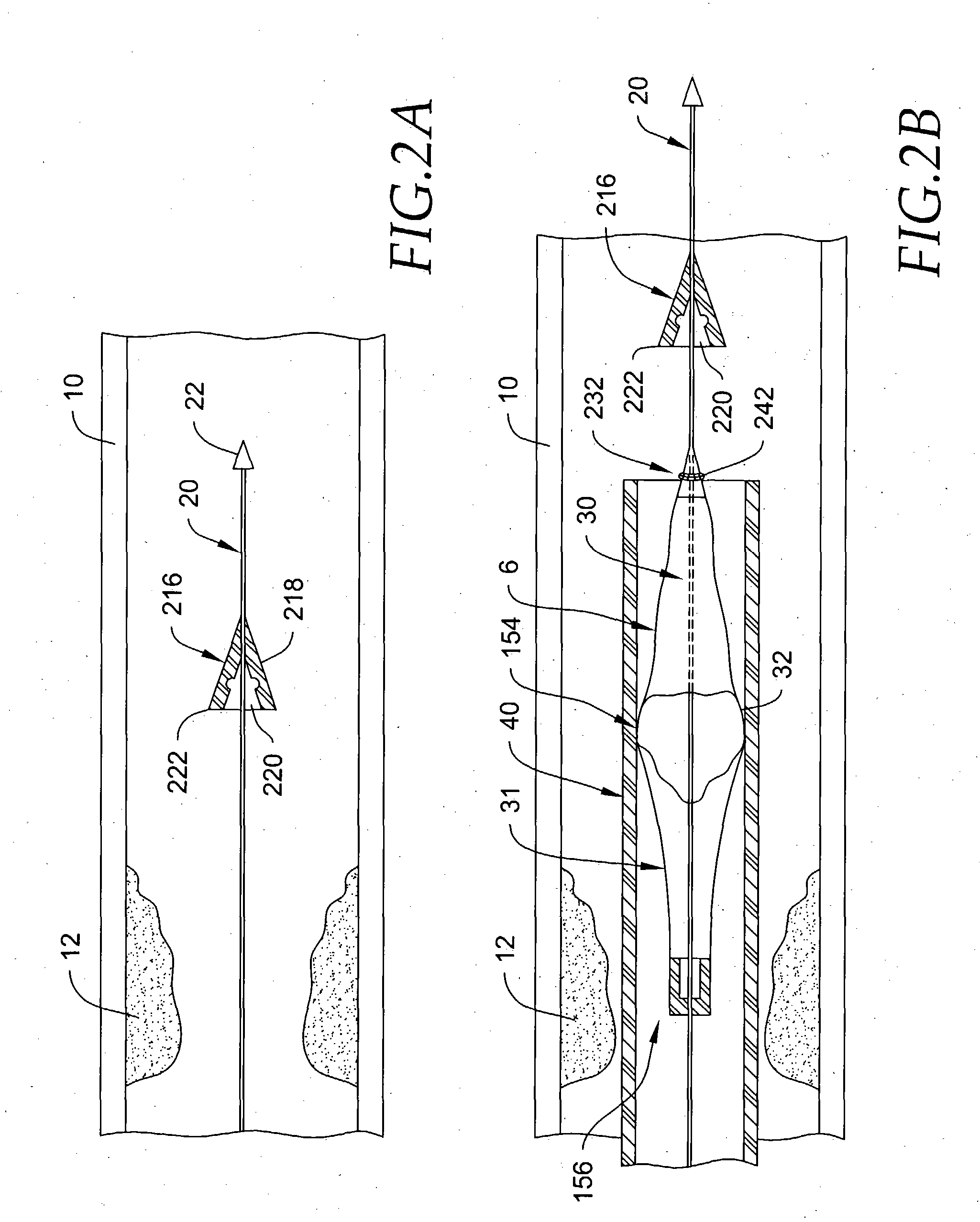 Embolic protection aspirator