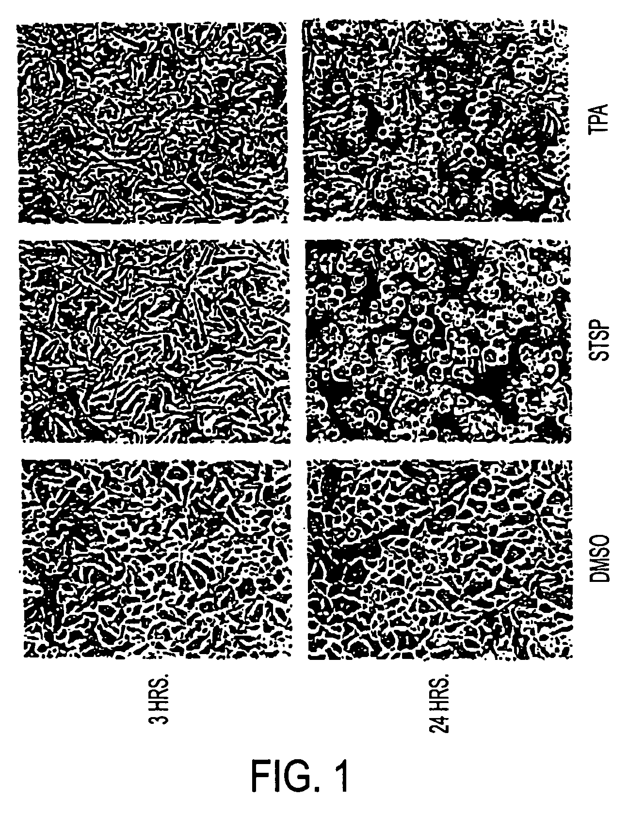 Pharmaceutical compositions and methods for preventing skin tumor formation and causing regression of existing tumors