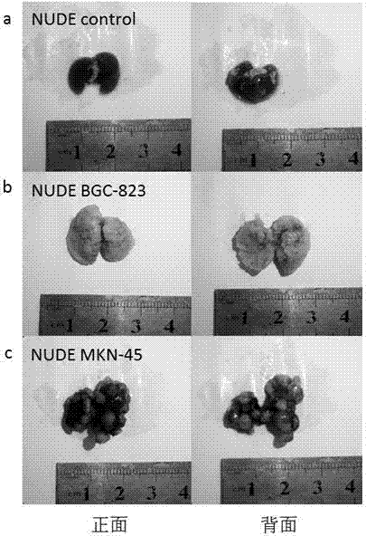 Mouse model with lung metastasis of gastric cancer and establishment method thereof