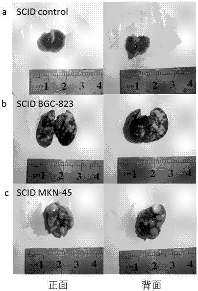 Mouse model with lung metastasis of gastric cancer and establishment method thereof