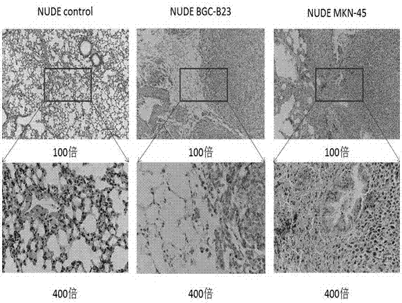 Mouse model with lung metastasis of gastric cancer and establishment method thereof