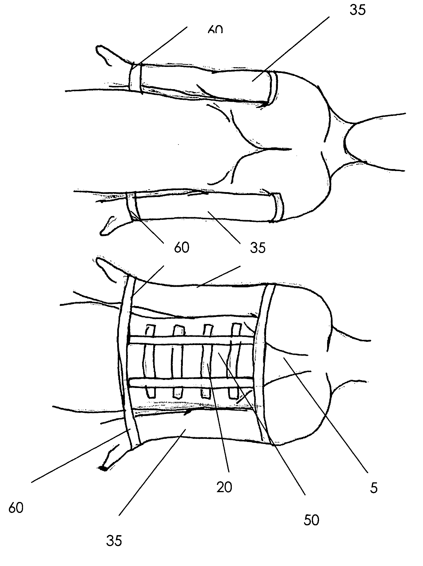 Altered range of motion device